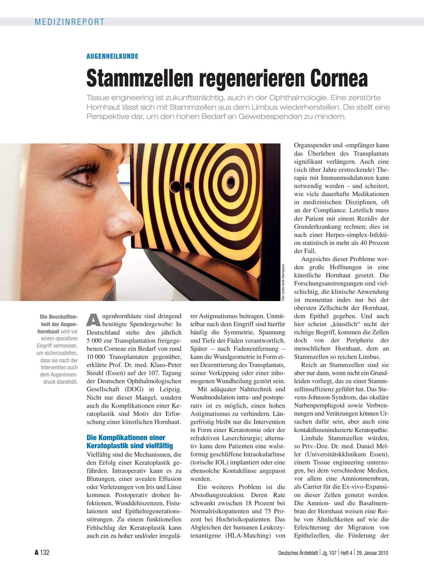 Vorschauseite 1: Augenheilkunde: Stammzellen regenerieren Cornea – Deutsches Ärzteblatt