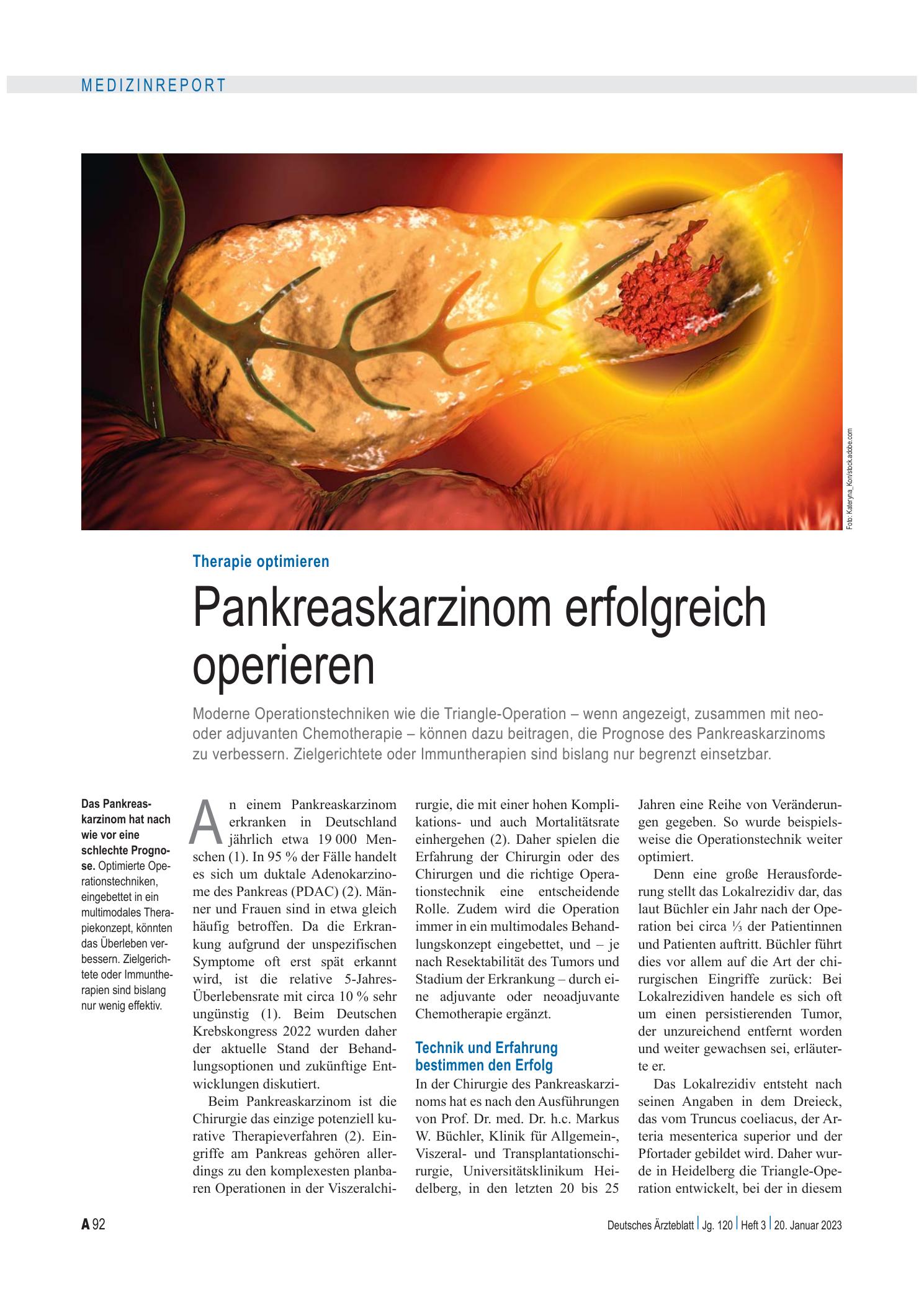 Vorschauseite 1: Therapie optimieren: Pankreaskarzinom erfolgreich operieren – Deutsches Ärzteblatt