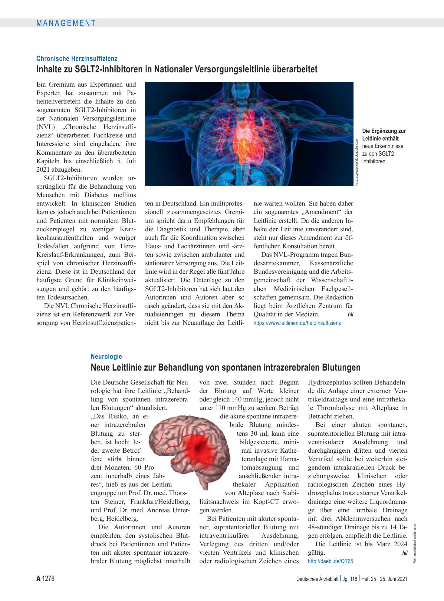 Vorschauseite 1: Neurologie: Neue Leitlinie zur Behandlung von spontanen intrazerebralen Blutungen – Deutsches Ärzteblatt