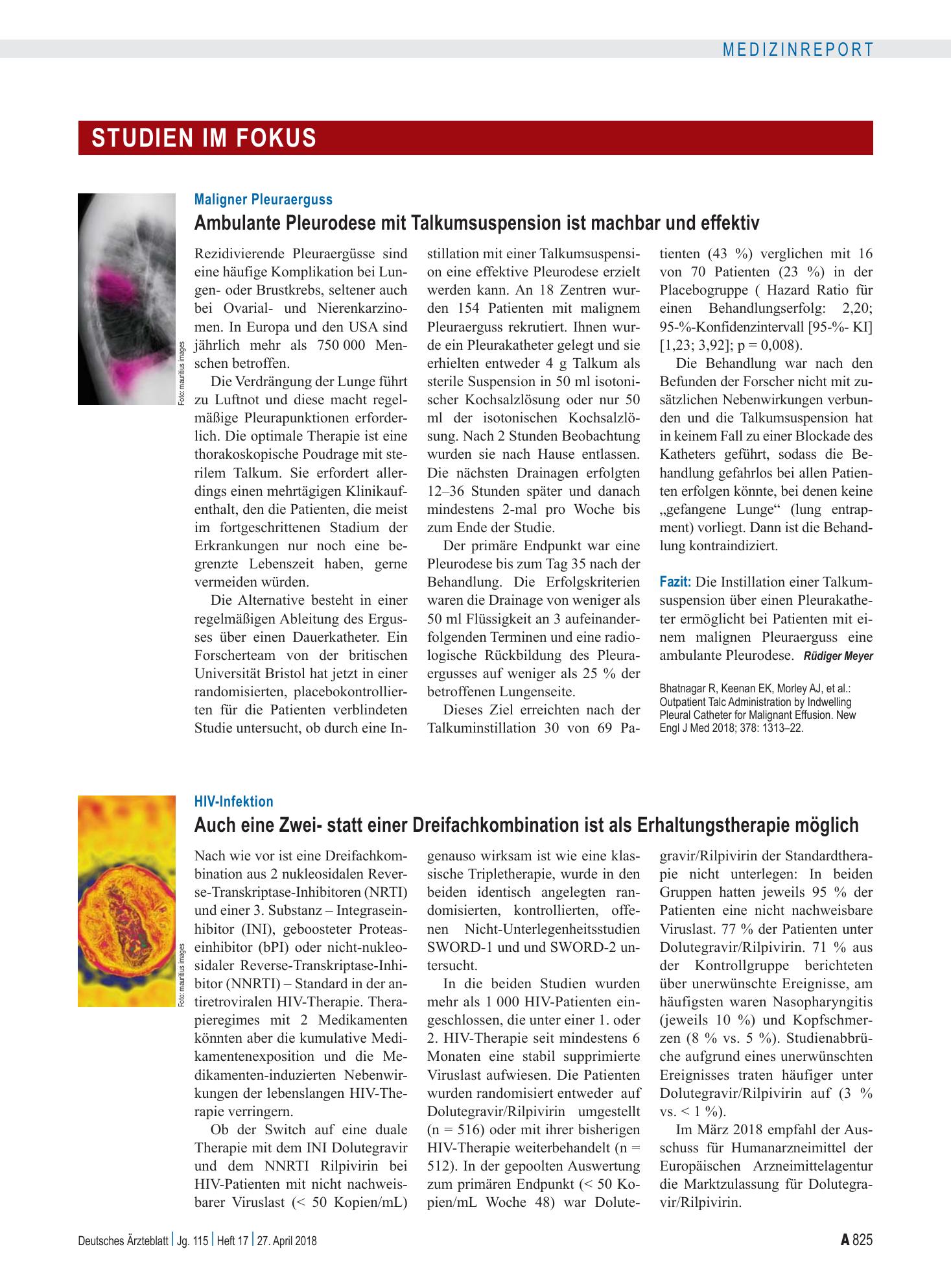 Vorschauseite 1: Maligner Pleuraerguss: Ambulante Pleurodese mit Talkumsuspension ist machbar und effektiv – Deutsches Ärzteblatt