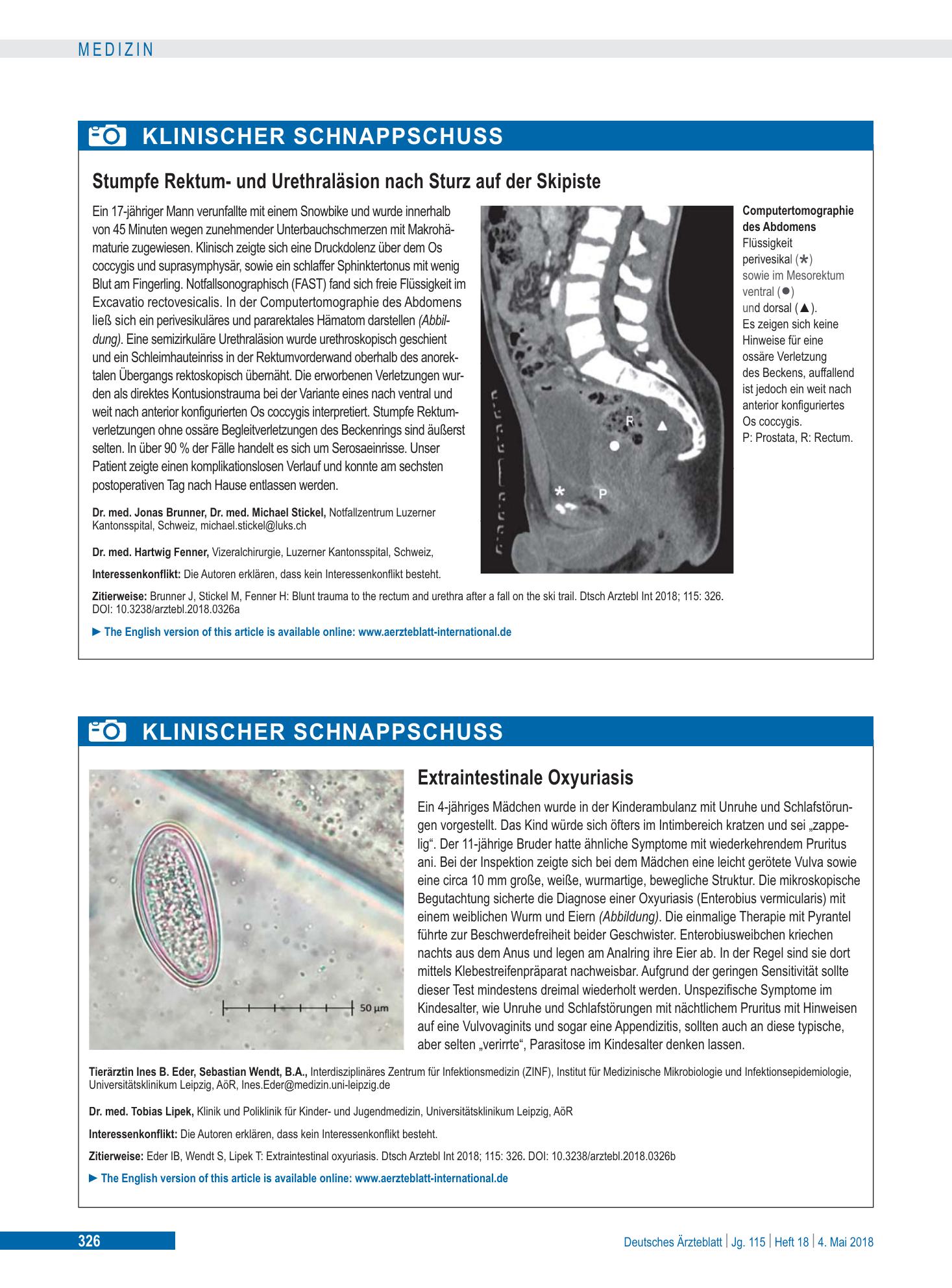Vorschauseite 1: Extraintestinale Oxyuriasis – Deutsches Ärzteblatt