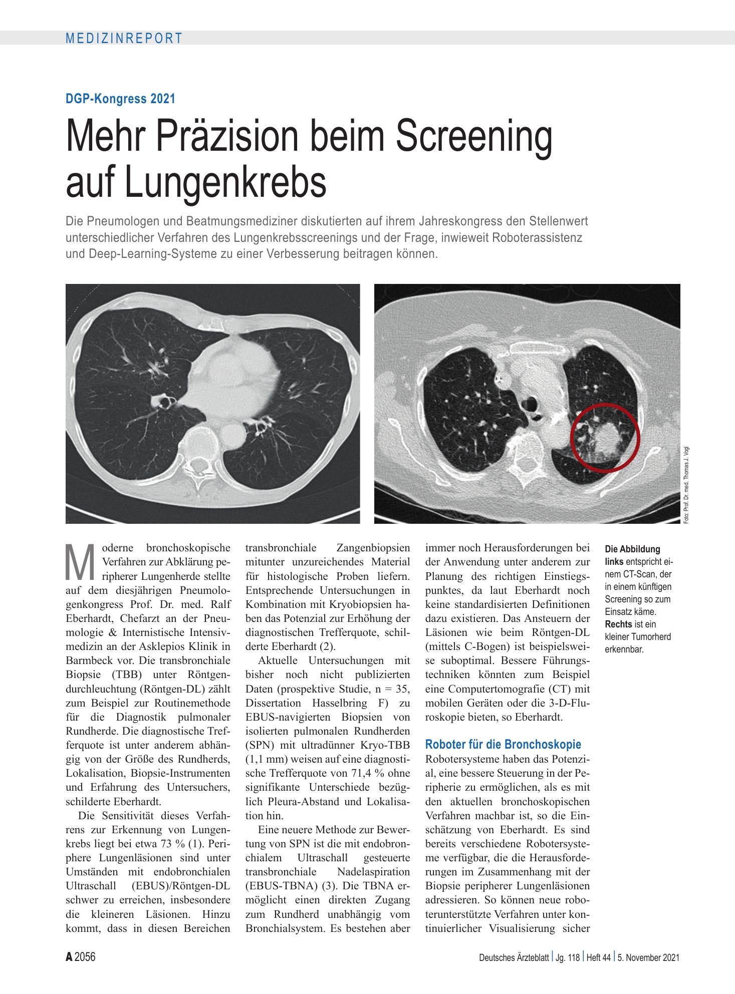 Vorschauseite 1: DGP-Kongress 2021: Mehr Präzision beim Screening auf Lungenkrebs – Deutsches Ärzteblatt