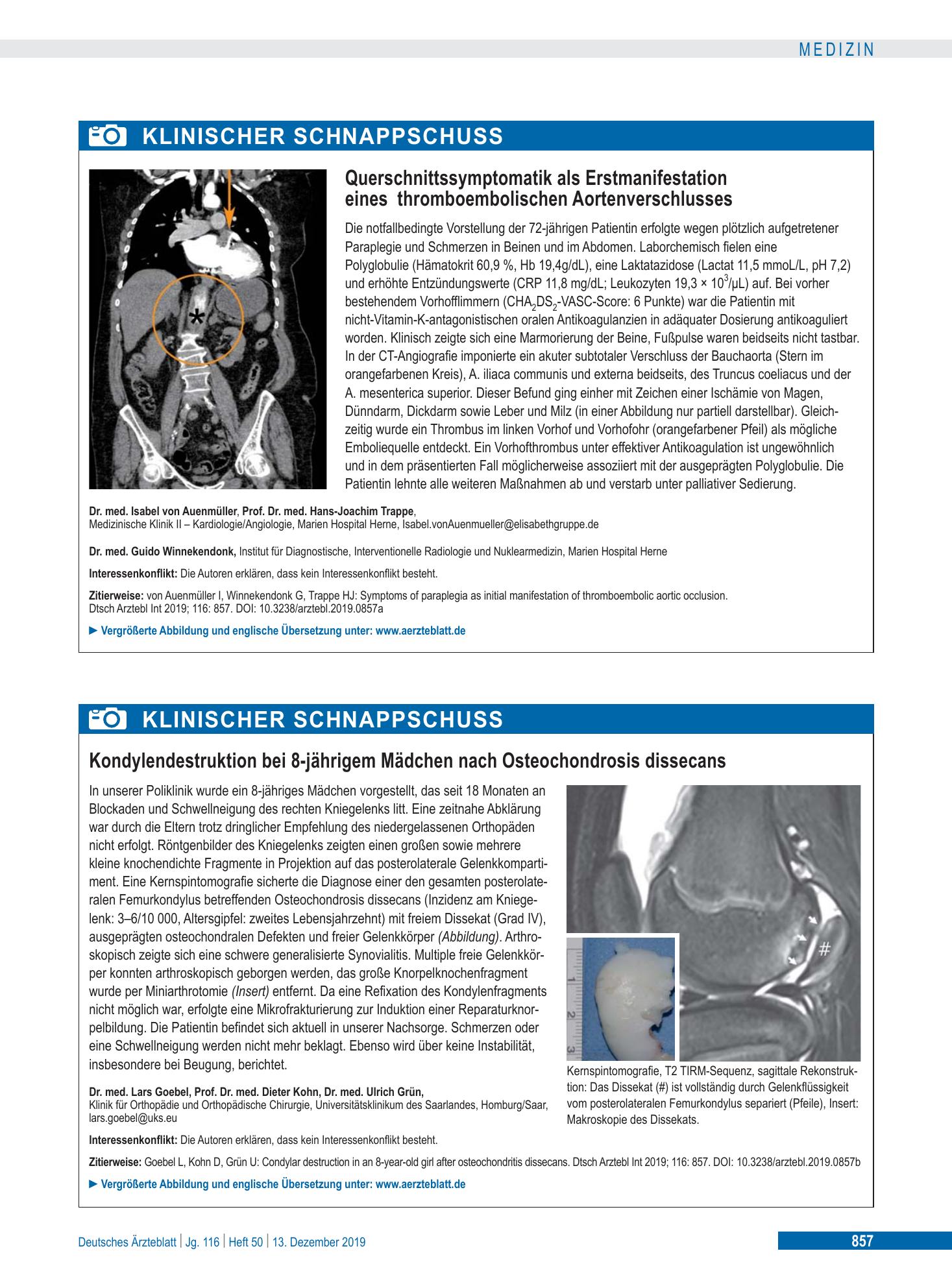 Vorschauseite 1: Querschnittssymptomatik als Erstmanifestation eines thromboembolischen Aortenverschlusses – Deutsches Ärzteblatt