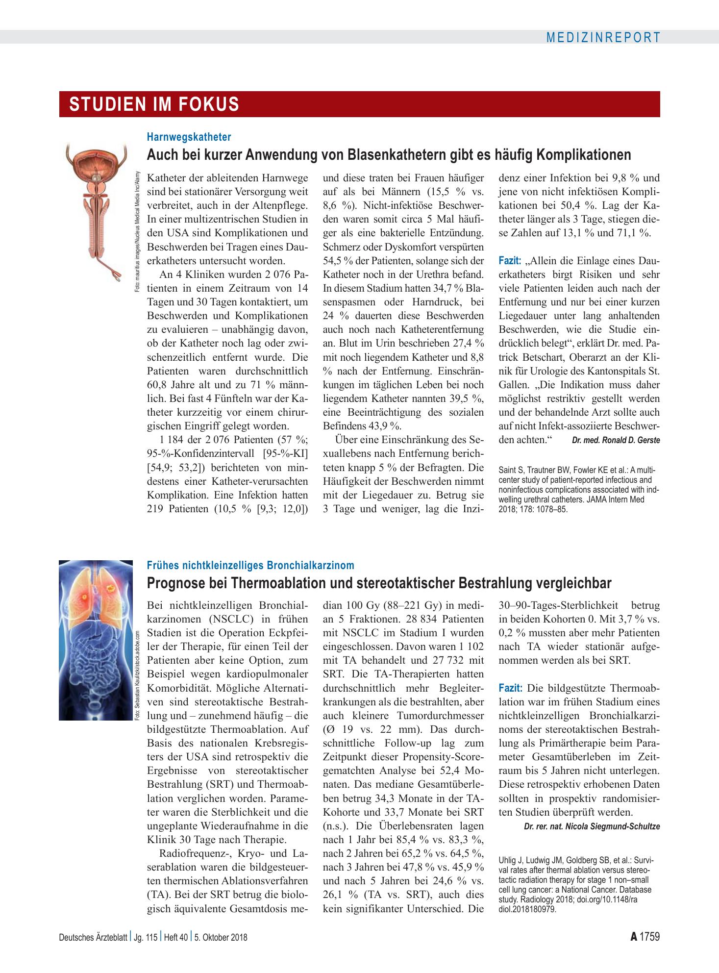 Vorschauseite 1: Frühes nichtkleinzelliges Bronchialkarzinom: Prognose bei Thermoablation und stereotaktischer Bestrahlung vergleichbar – Deutsches Ärzteblatt