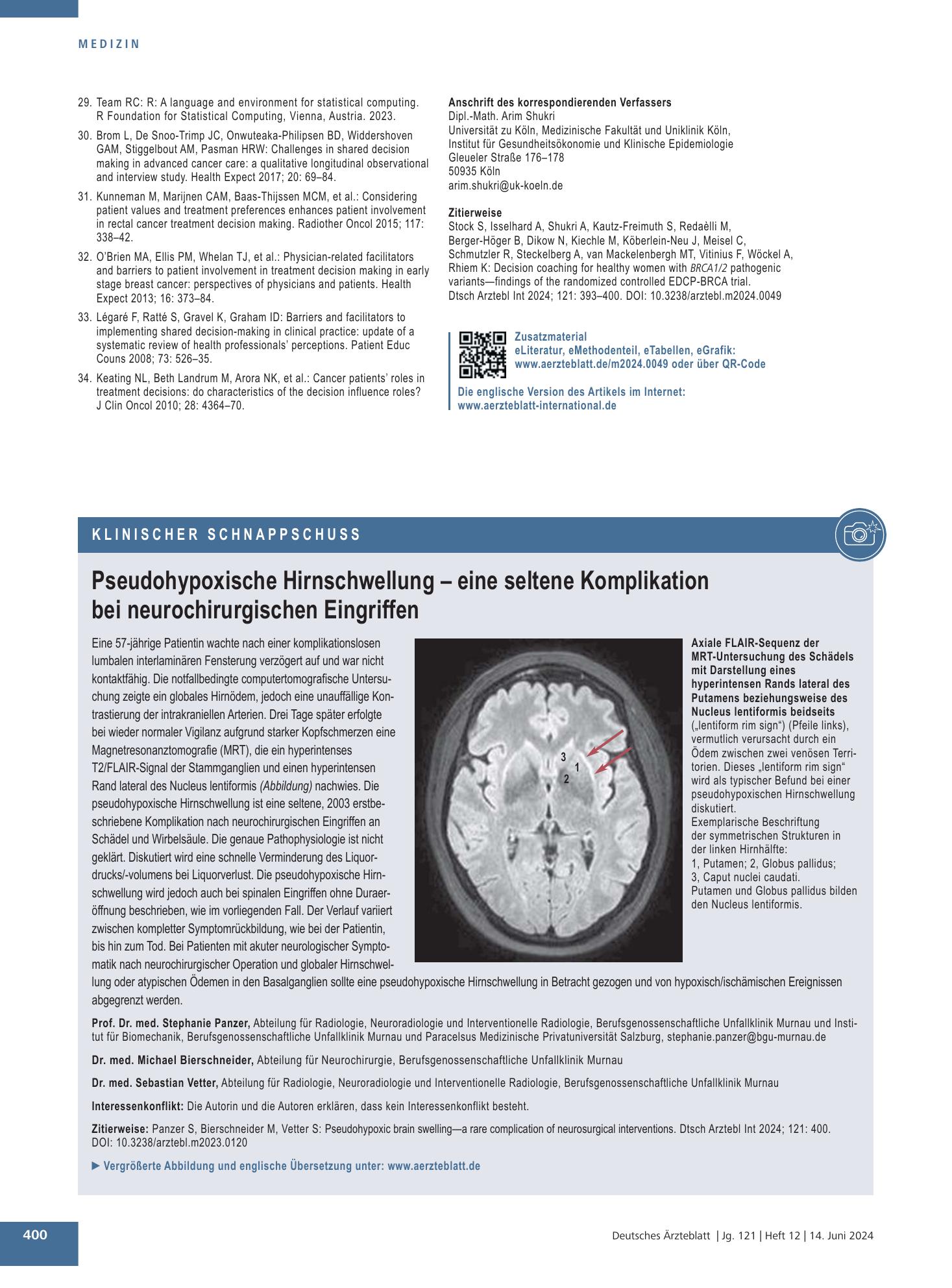 Vorschauseite 1: Pseudohypoxische Hirnschwellung – eine seltene Komplikation bei neurochirurgischen Eingriffen – Deutsches Ärzteblatt