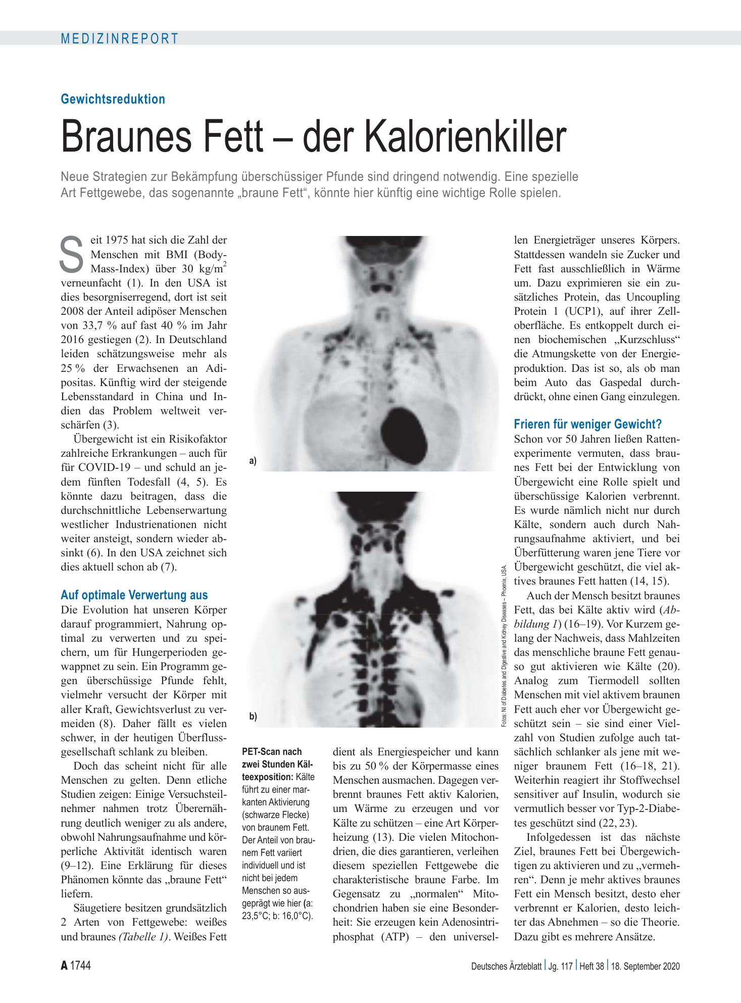 Vorschauseite 1: Gewichtsreduktion: Braunes Fett – der Kalorienkiller – Deutsches Ärzteblatt