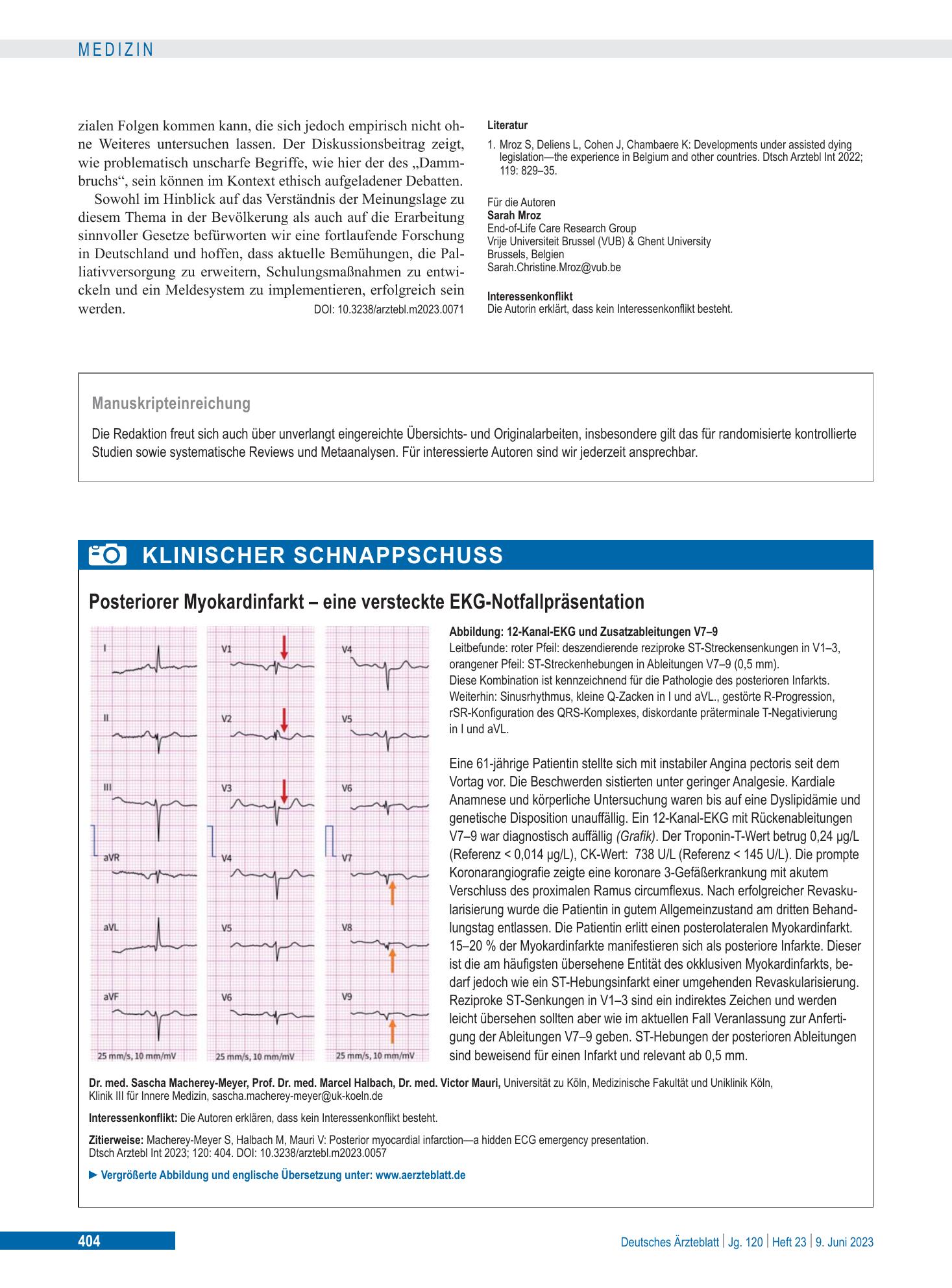 Vorschauseite 1: Posteriorer Myokardinfarkt – eine versteckte EKG-Notfallpräsentation – Deutsches Ärzteblatt