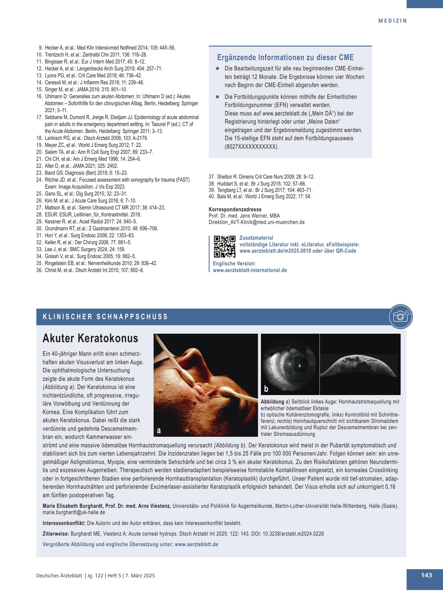 Vorschauseite 1: Akuter Keratokonus – Deutsches Ärzteblatt