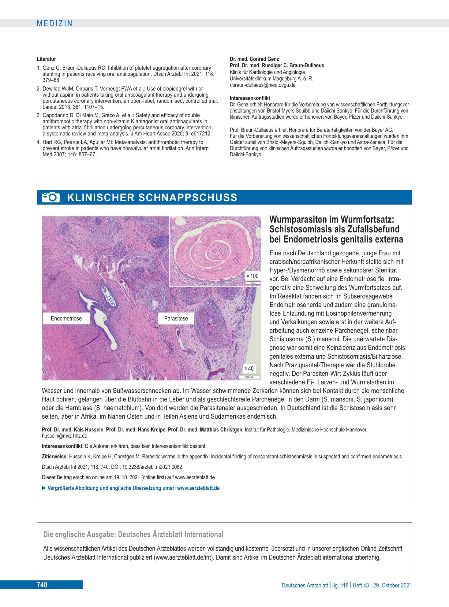 Vorschauseite 1: Wurmparasiten im Wurmfortsatz: Schistosomiasis als Zufallsbefund bei Endometriosis genitalis externa – Deutsches Ärzteblatt