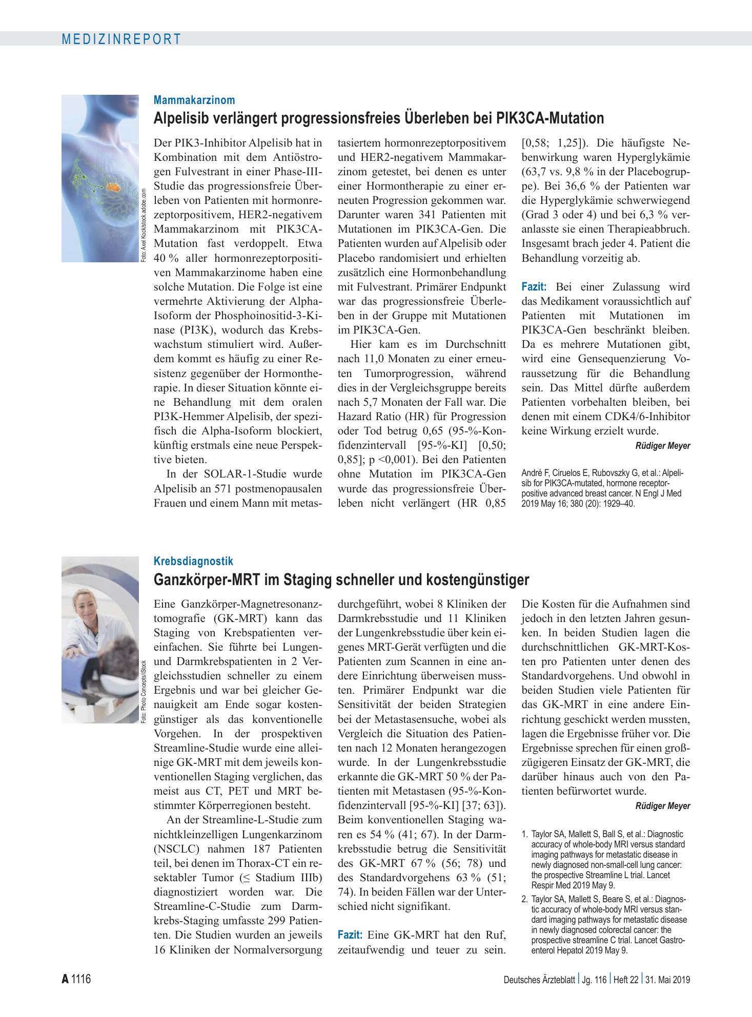 Vorschauseite 1: Mammakarzinom: Alpelisib verlängert progressionsfreies Überleben bei PIK3CA-Mutation – Deutsches Ärzteblatt