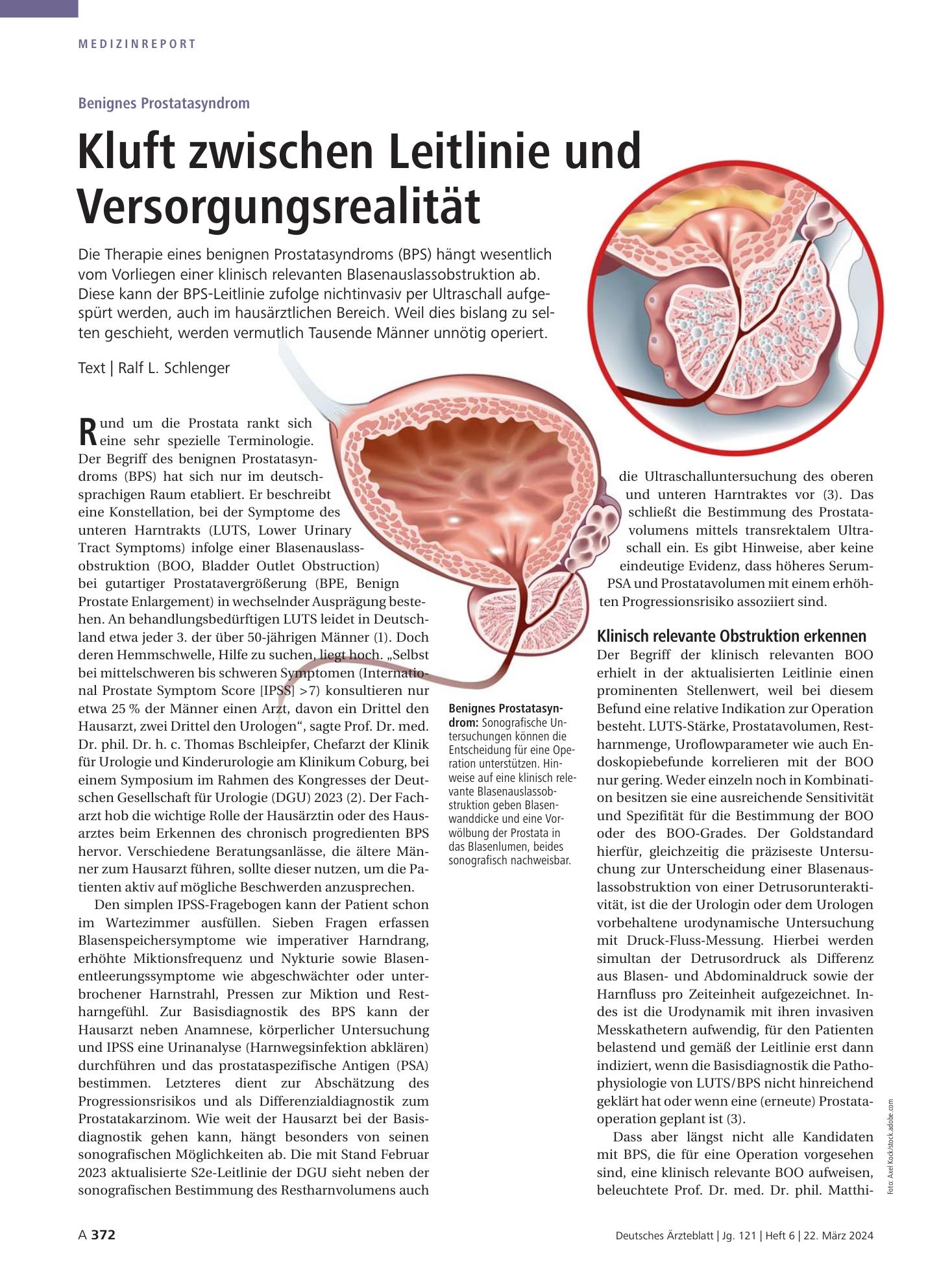Vorschauseite 1: Benignes Prostatasyndrom: Kluft zwischen Leitlinie und Versorgungsrealität – Deutsches Ärzteblatt