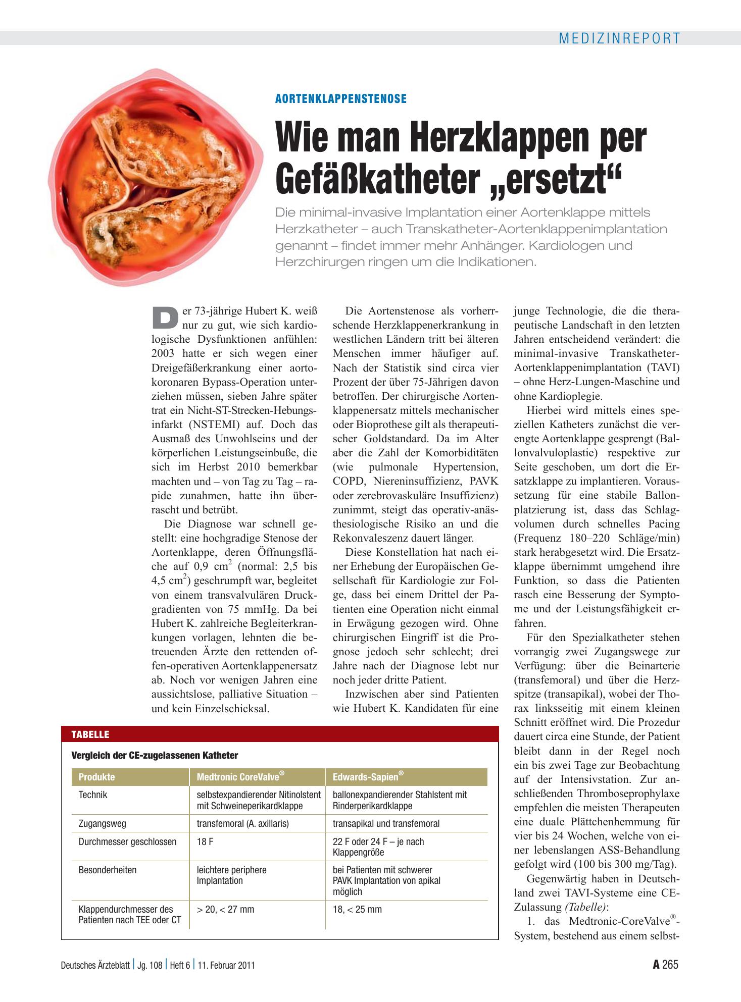 Vorschauseite 1: Aortenklappenstenose: Wie man Herzklappen per Gefäßkatheter „ersetzt“ – Deutsches Ärzteblatt
