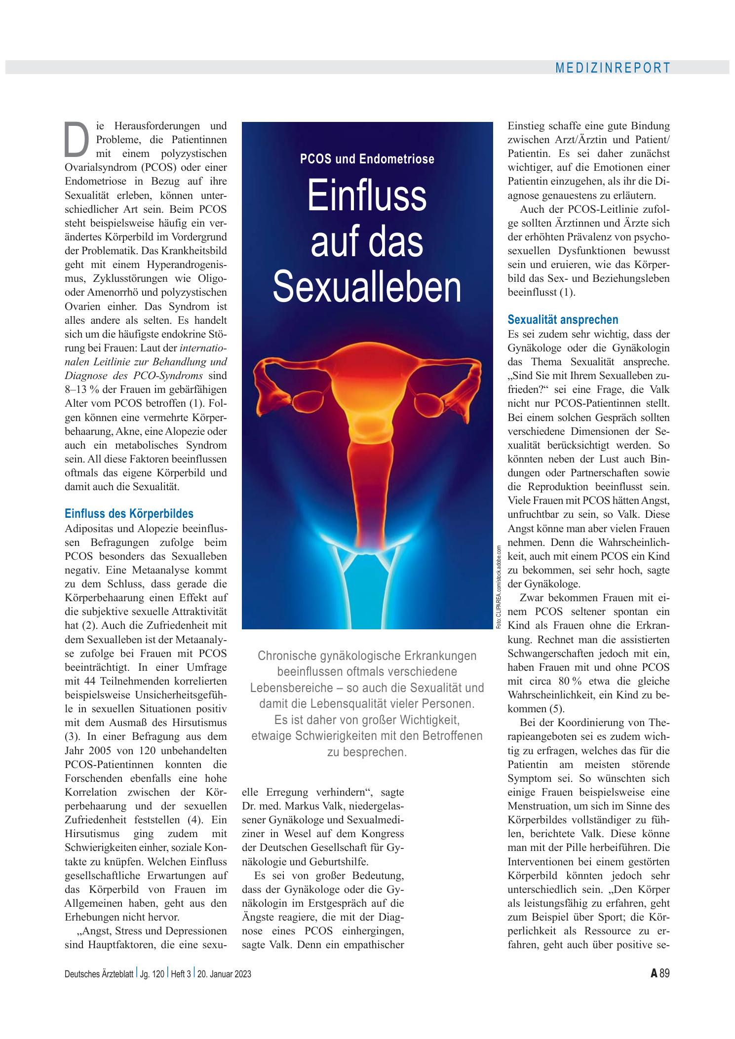 Vorschauseite 1: PCOS und Endometriose: Einfluss auf das Sexualleben – Deutsches Ärzteblatt