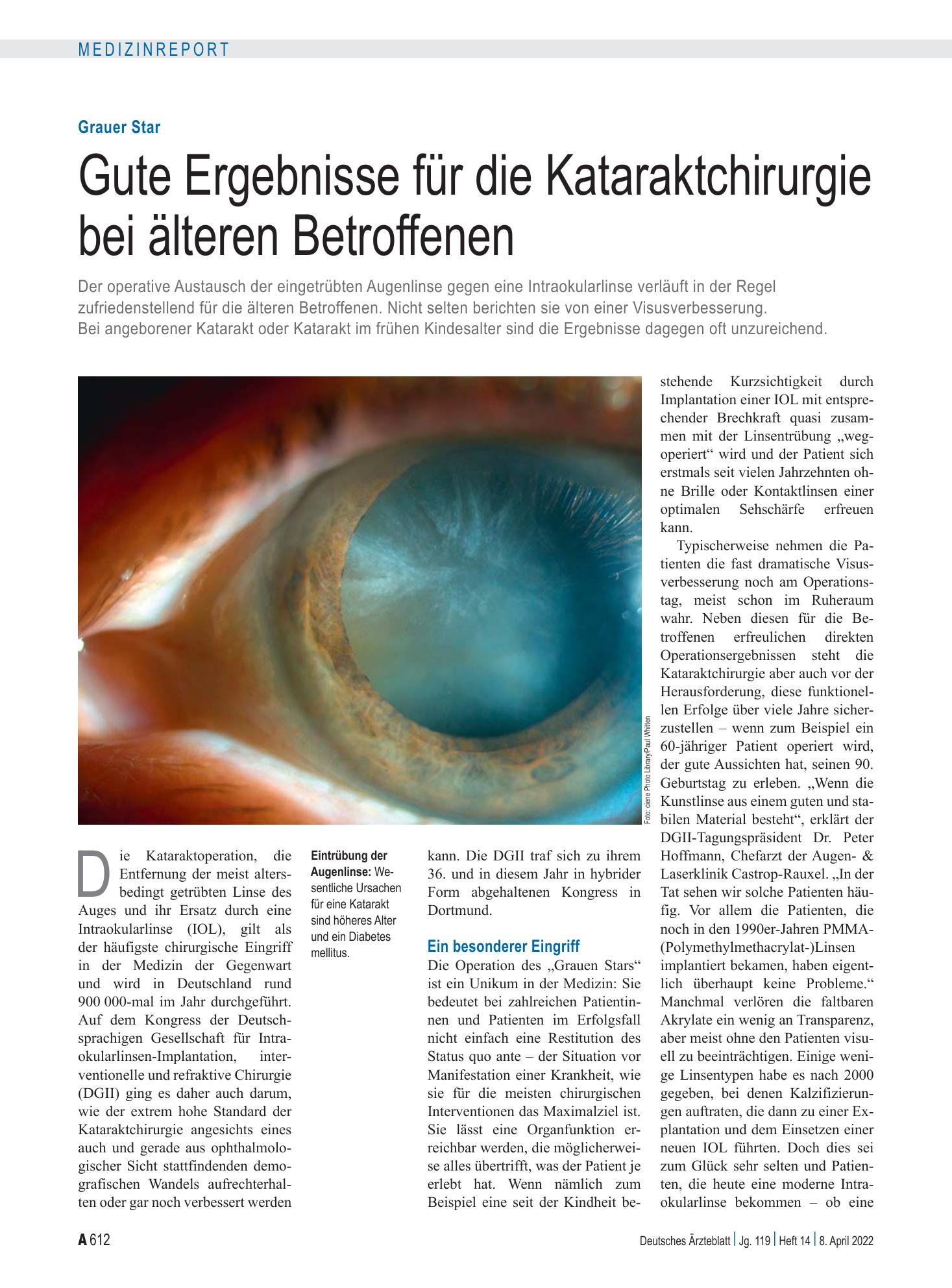 Vorschauseite 1: Grauer Star: Gute Ergebnisse für die Kataraktchirurgie bei älteren Betroffenen – Deutsches Ärzteblatt