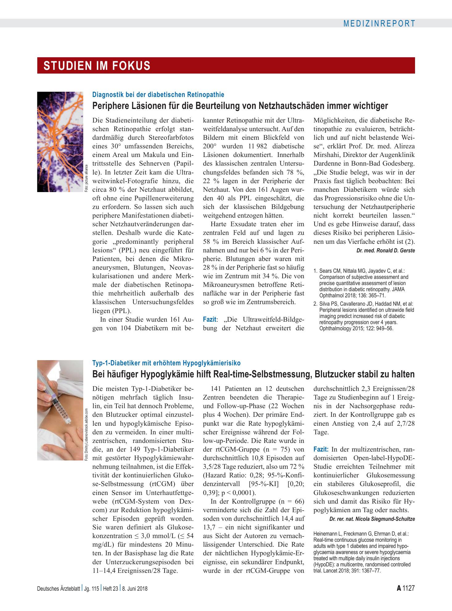 Vorschauseite 1: Typ-1-Diabetiker mit erhöhtem Hypoglykämierisiko: Bei häufiger Hypoglykämie hilft Real-time-Selbstmessung, Blutzucker stabil zu halten – Deutsches Ärzteblatt