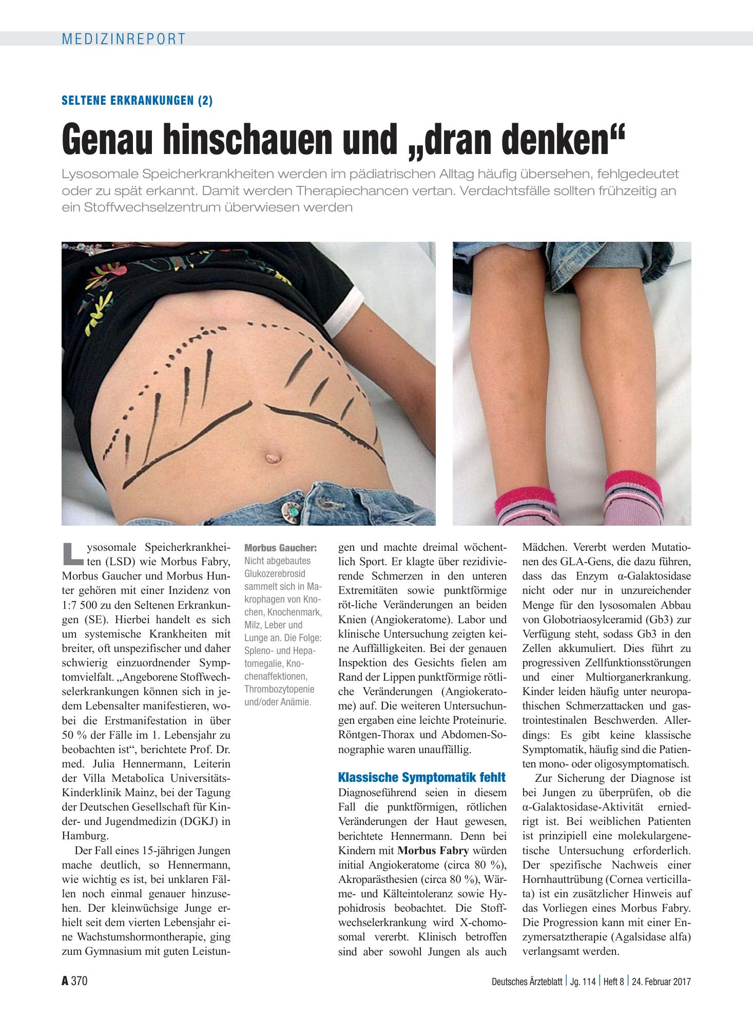 Vorschauseite 1: Seltene Erkrankungen (2): Genau hinschauen und „dran denken“ – Deutsches Ärzteblatt