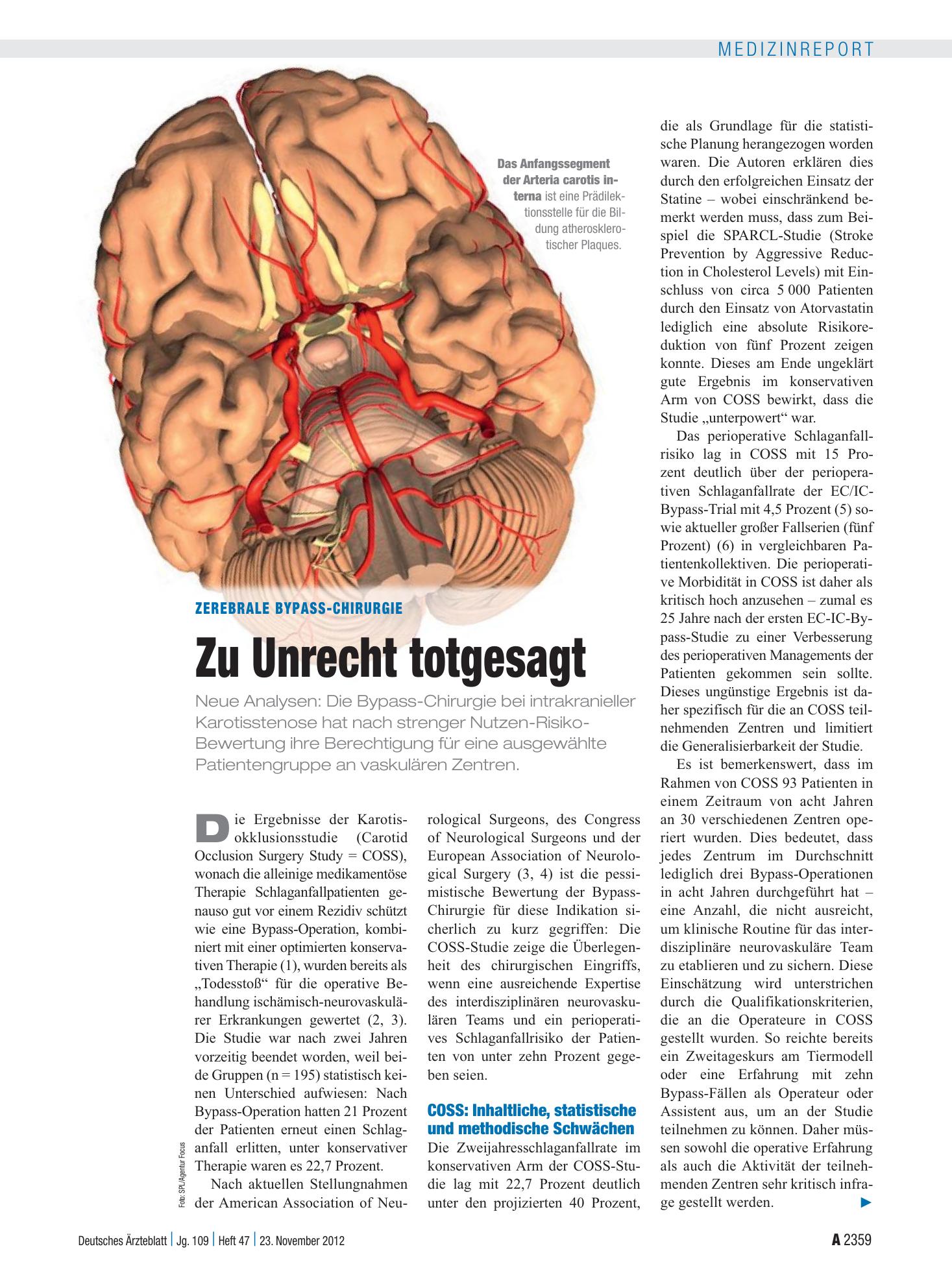 Vorschauseite 1: Zerebrale Bypass-Chirurgie: Zu Unrecht totgesagt – Deutsches Ärzteblatt