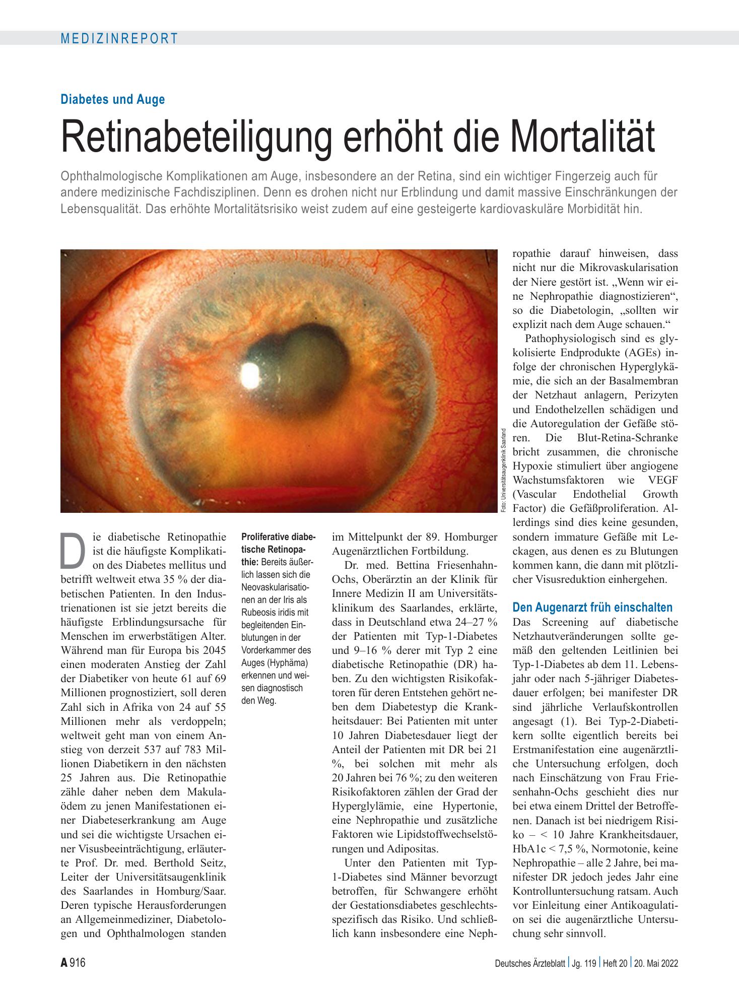 Vorschauseite 1: Diabetes und Auge: Retinabeteiligung erhöht die Mortalität – Deutsches Ärzteblatt