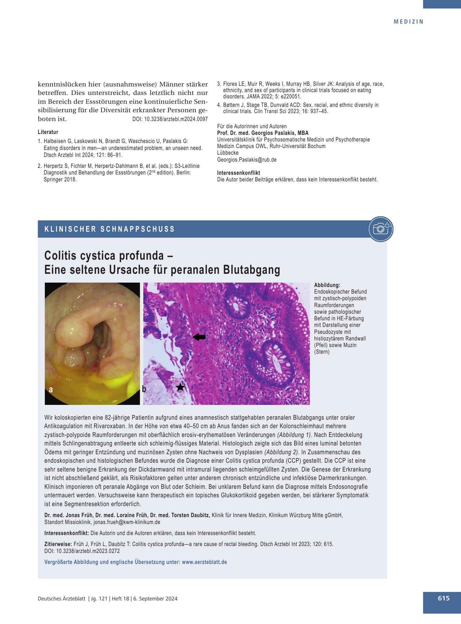 Vorschauseite 1: Colitis cystica profunda – Eine seltene Ursache für peranalen Blutabgang – Deutsches Ärzteblatt