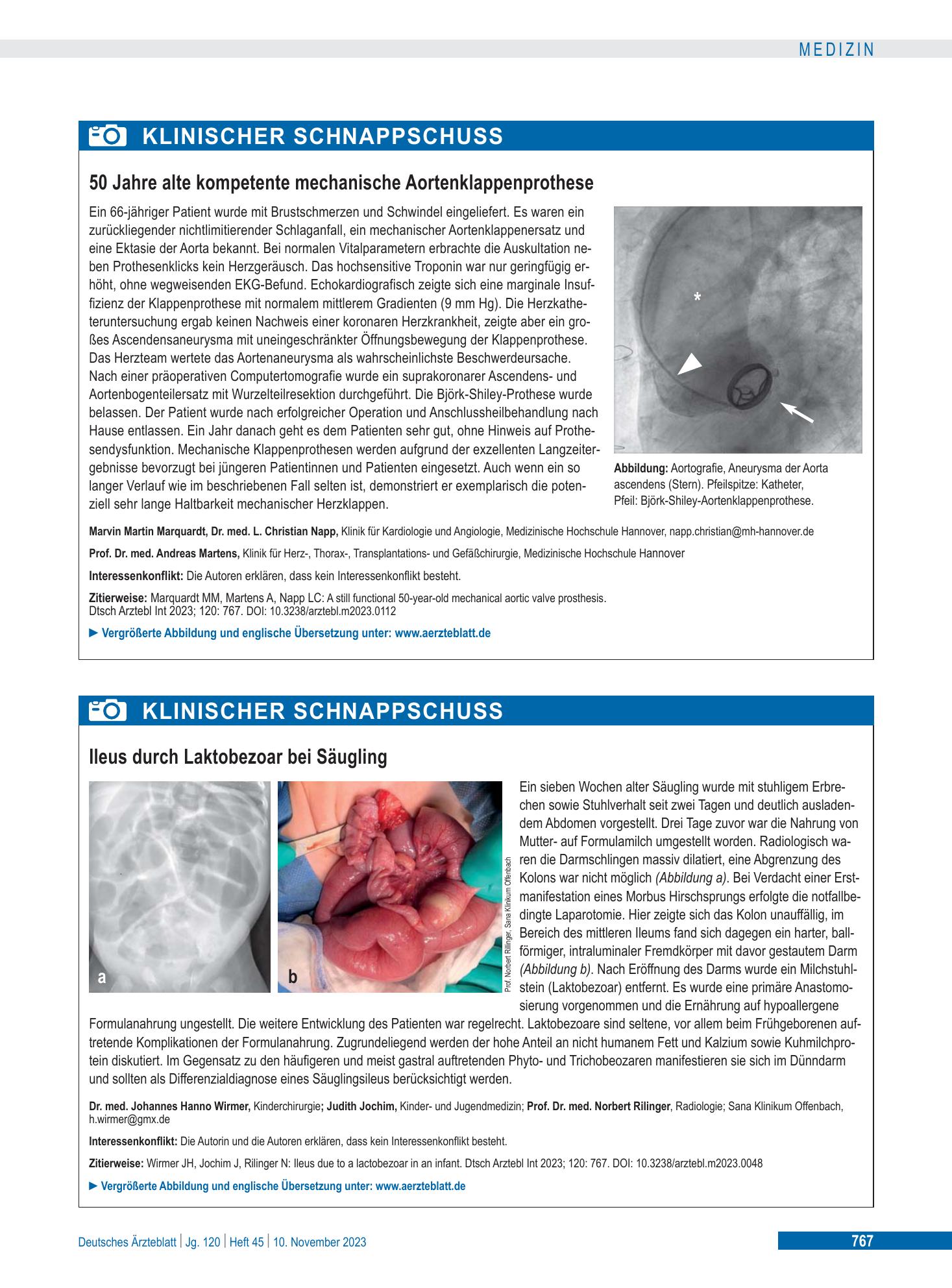 Vorschauseite 1: Ileus durch Laktobezoar bei Säugling – Deutsches Ärzteblatt