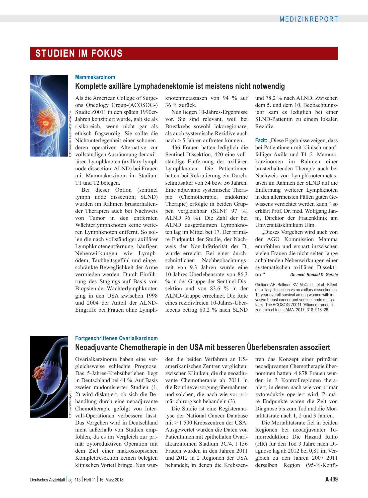 Vorschauseite 1: Mammakarzinom: Komplette axilläre Lymphadenektomie ist meistens nicht notwendig – Deutsches Ärzteblatt