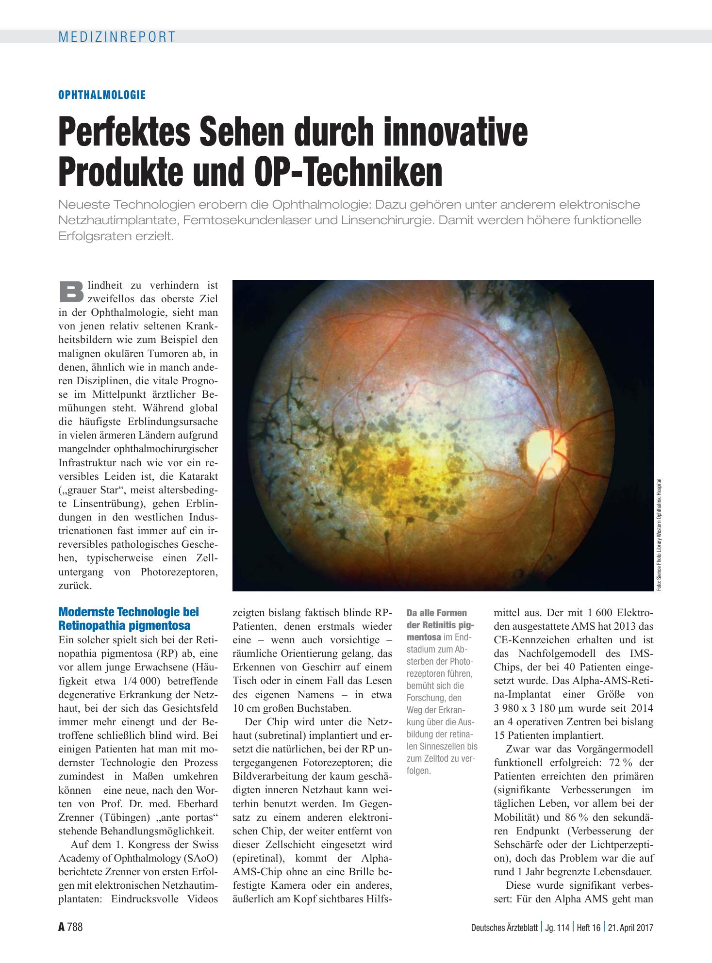 Vorschauseite 1: Ophthalmologie: Perfektes Sehen durch innovative Produkte und OP-Techniken – Deutsches Ärzteblatt