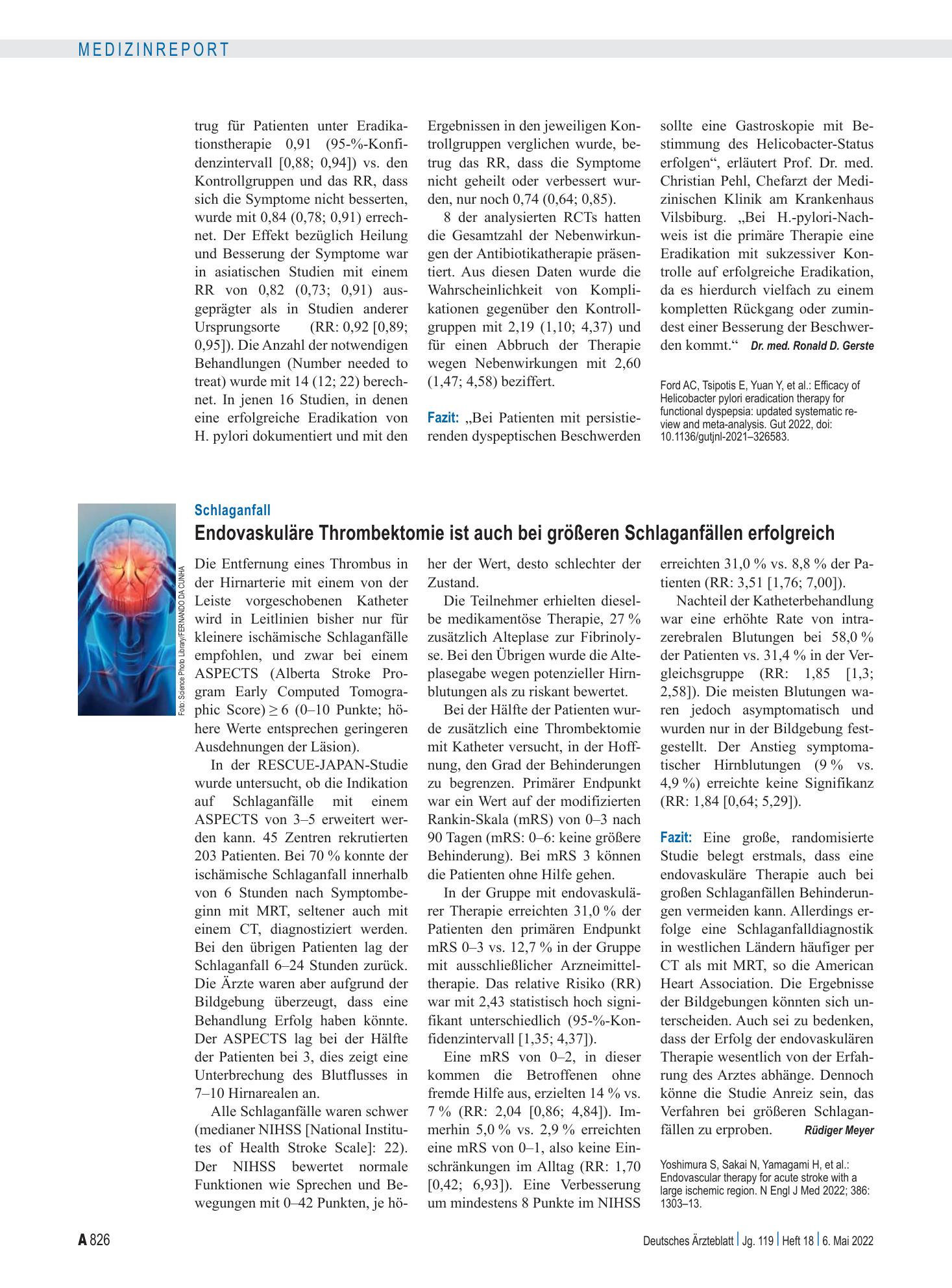 Vorschauseite 1: Schlaganfall: Endovaskuläre Thrombektomie ist auch bei größeren Schlaganfällen erfolgreich – Deutsches Ärzteblatt