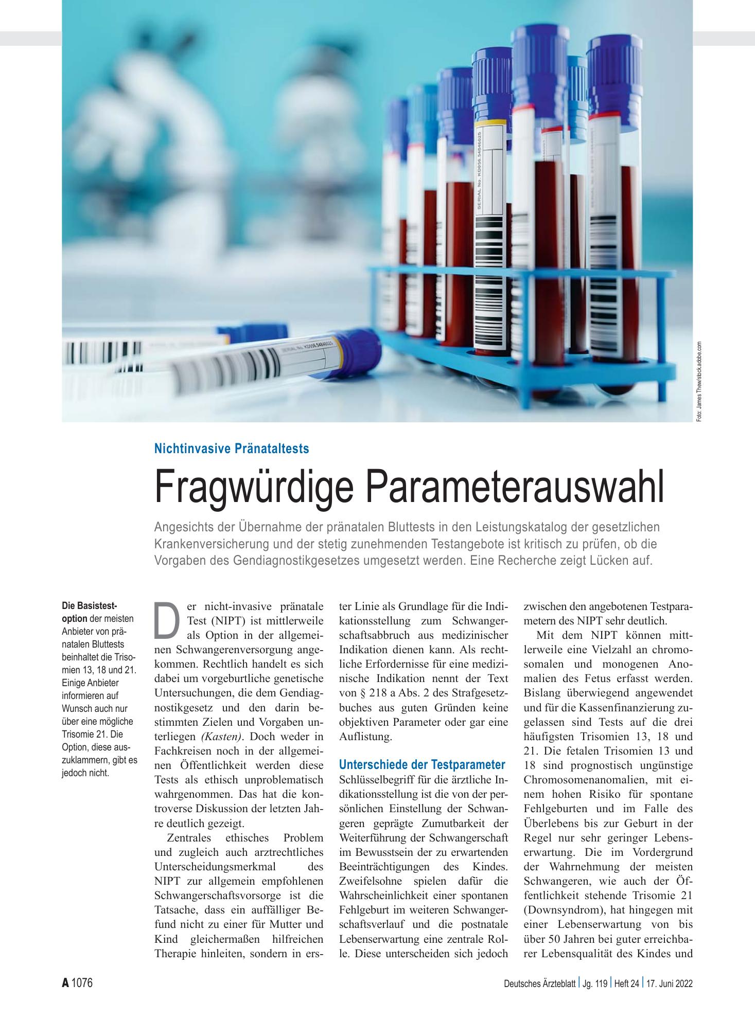 Vorschauseite 1: Nichtinvasive Pränataltests: Fragwürdige Parameterauswahl – Deutsches Ärzteblatt