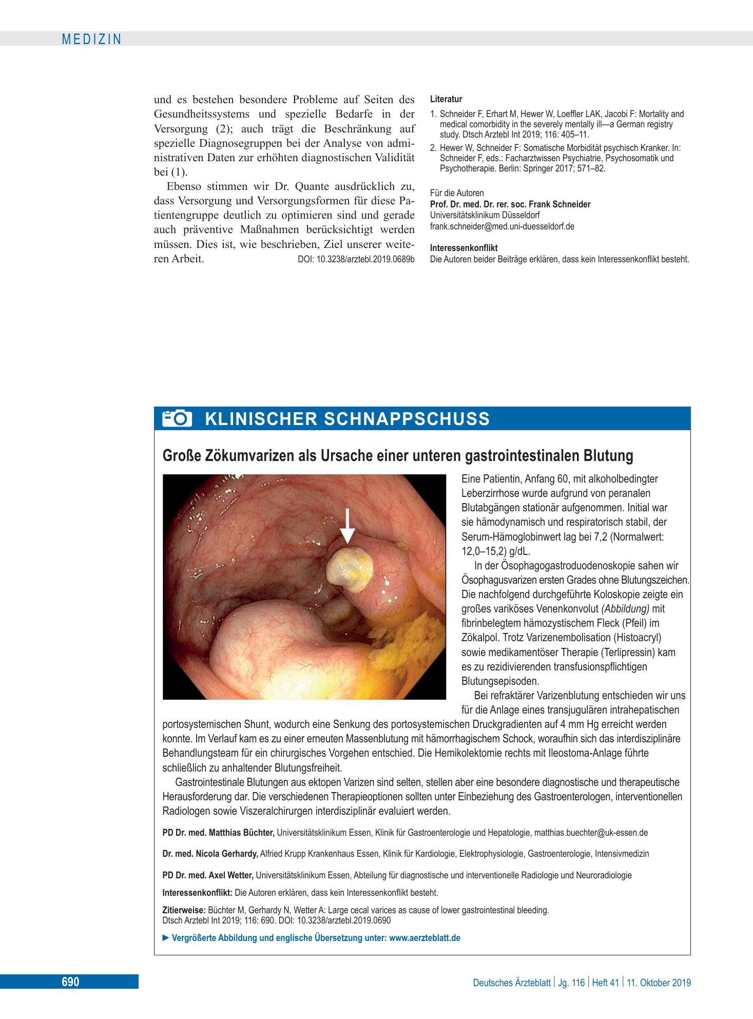 Vorschauseite 1: Große Zökumvarizen als Ursache einer unteren gastrointestinalen Blutung – Deutsches Ärzteblatt