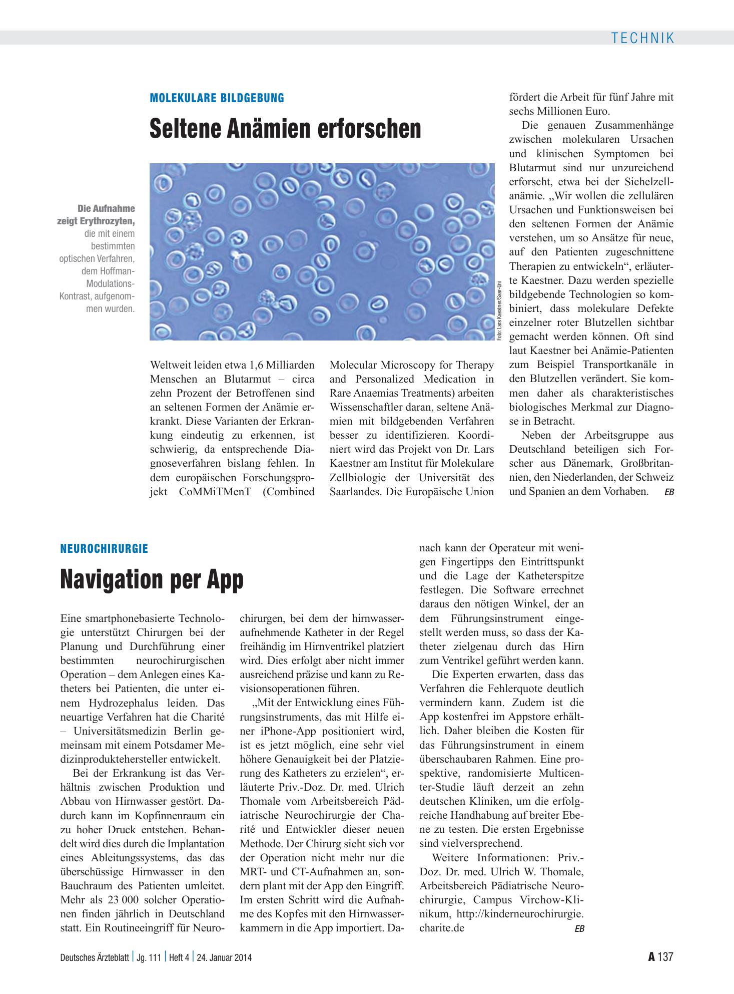 Vorschauseite 1: Neurochirurgie: Navigation per App – Deutsches Ärzteblatt