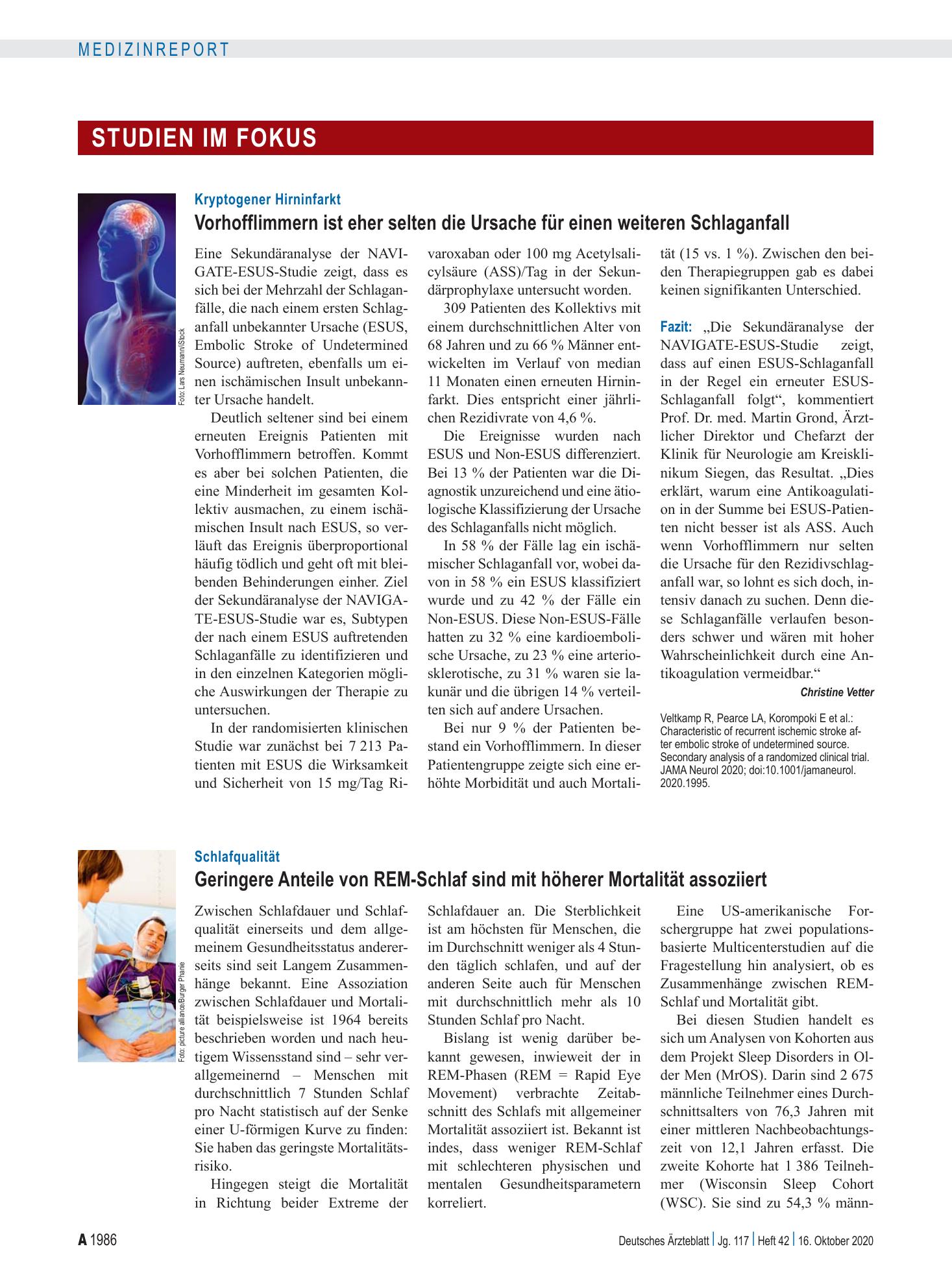Vorschauseite 1: Kryptogener Hirninfarkt: Vorhofflimmern ist eher selten die Ursache für einen weiteren Schlaganfall – Deutsches Ärzteblatt