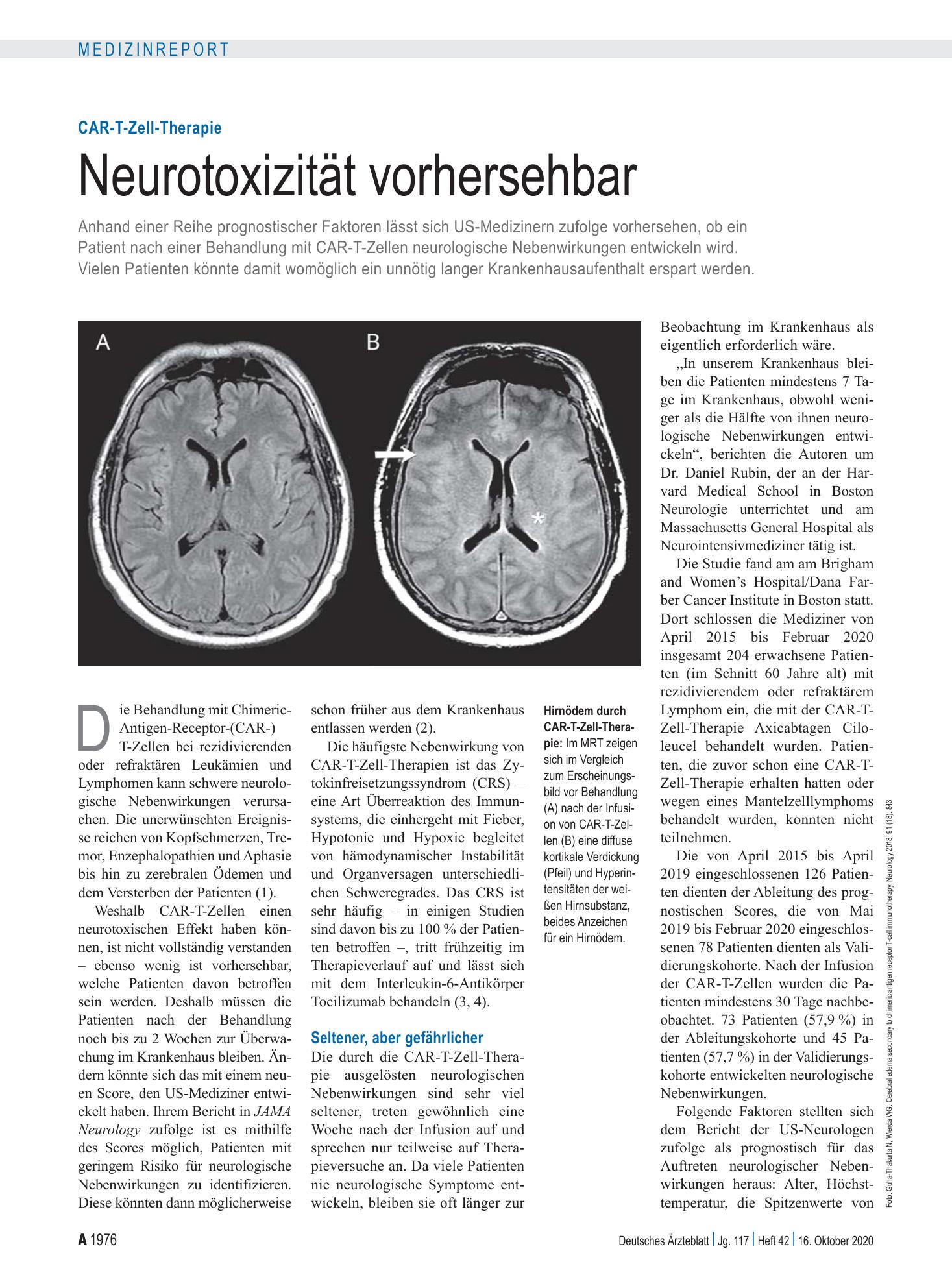 Vorschauseite 1: CAR-T-Zell-Therapie: Neurotoxizität vorhersehbar – Deutsches Ärzteblatt
