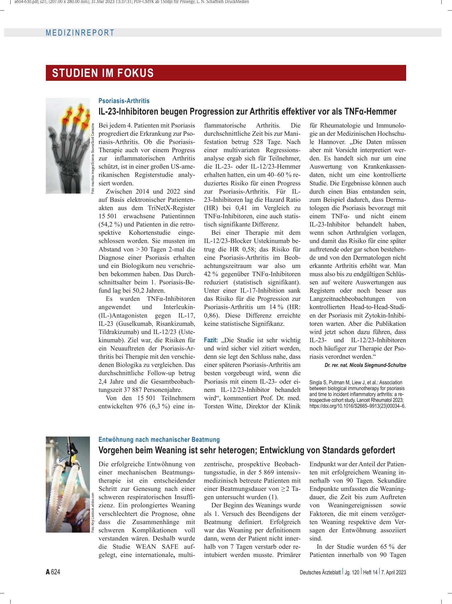 Vorschauseite 1: Psoriasis-Arthritis: IL-23-Inhibitoren beugen Progression zur Arthritis effektiver vor als TNFα-Hemmer – Deutsches Ärzteblatt