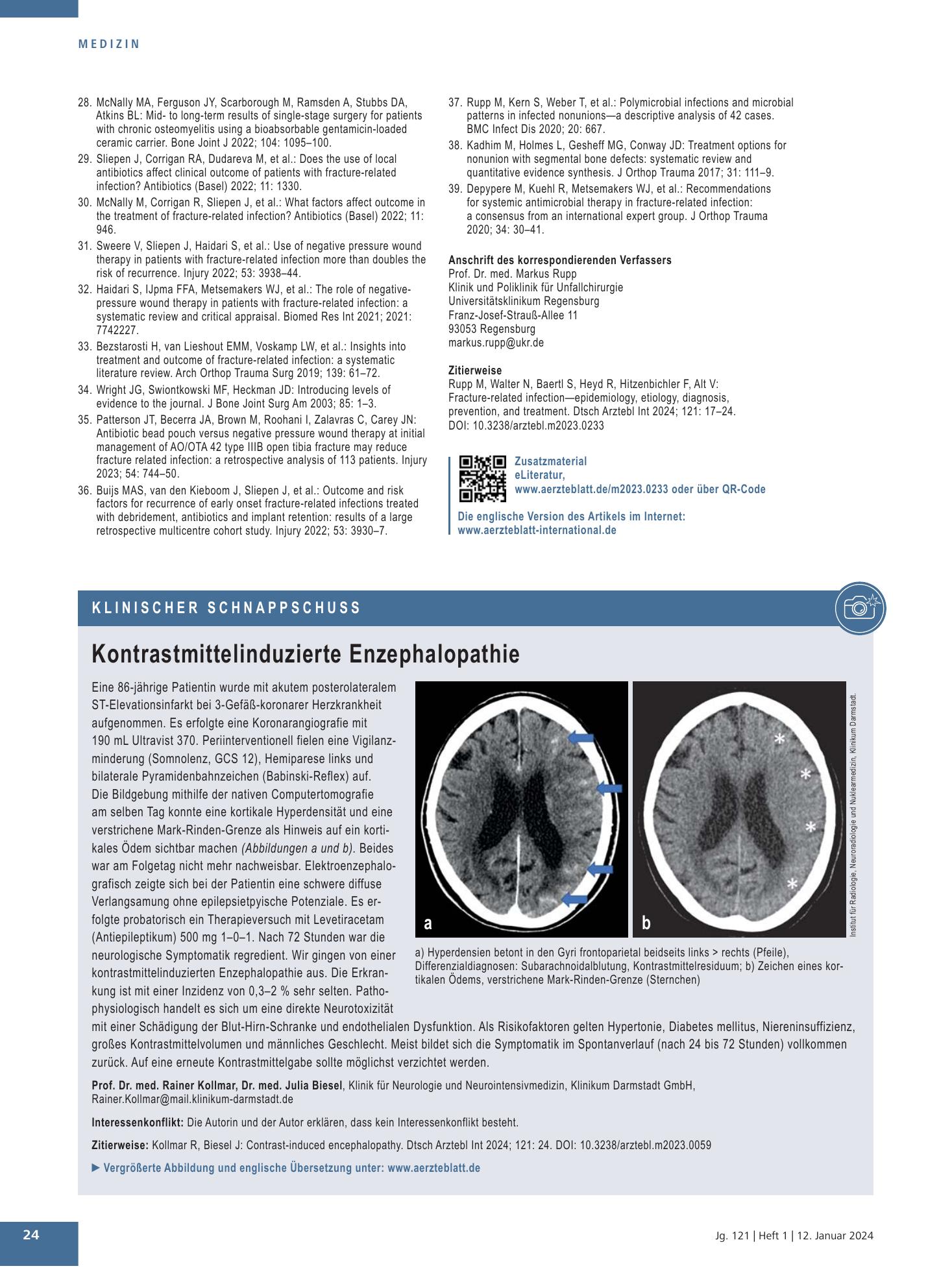 Vorschauseite 1: Kontrastmittelinduzierte Enzephalopathie – Deutsches Ärzteblatt