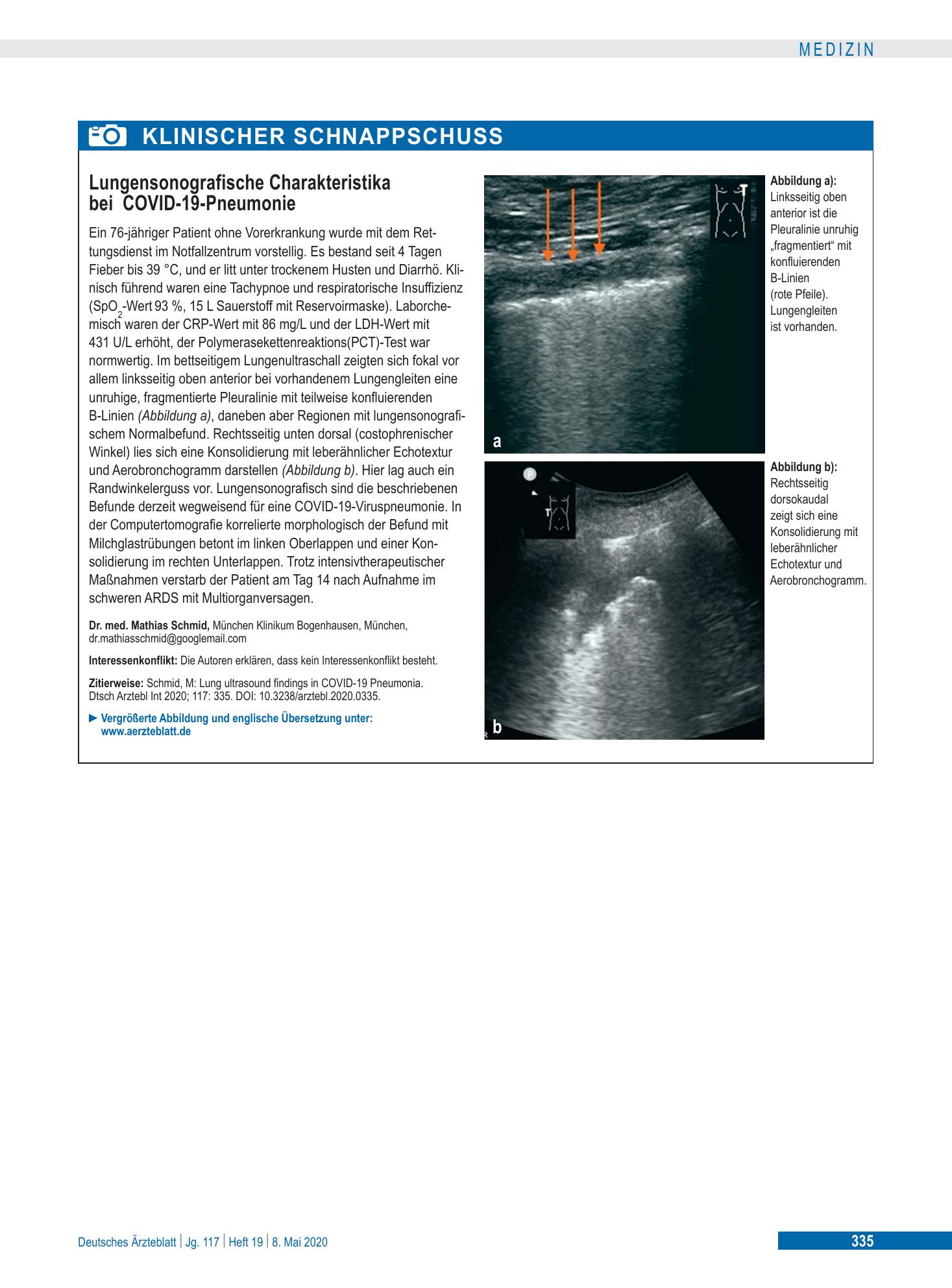Vorschauseite 1: Lungensonografische Charakteristika bei COVID-19-Pneumonie – Deutsches Ärzteblatt