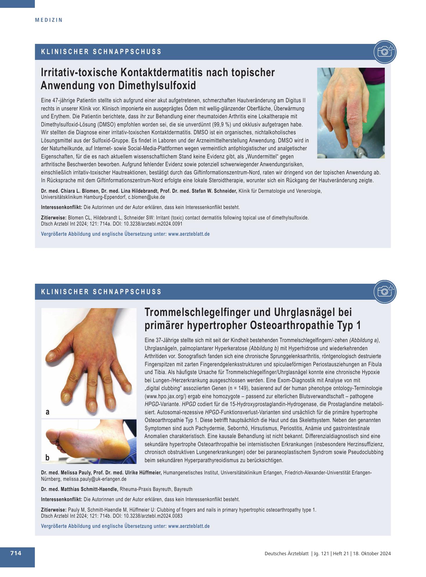 Vorschauseite 1: Trommelschlegelfinger und Uhrglasnägel bei primärer hypertropher Osteoarthropathie Typ 1 – Deutsches Ärzteblatt