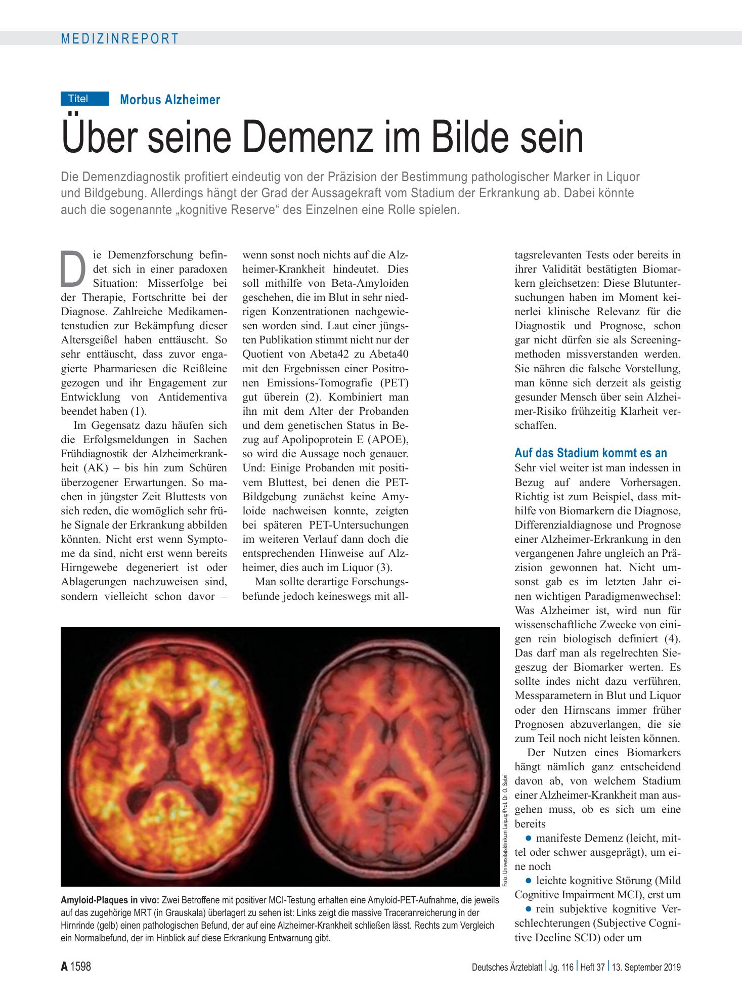 Vorschauseite 1: Morbus Alzheimer: Über seine Demenz im Bilde sein – Deutsches Ärzteblatt