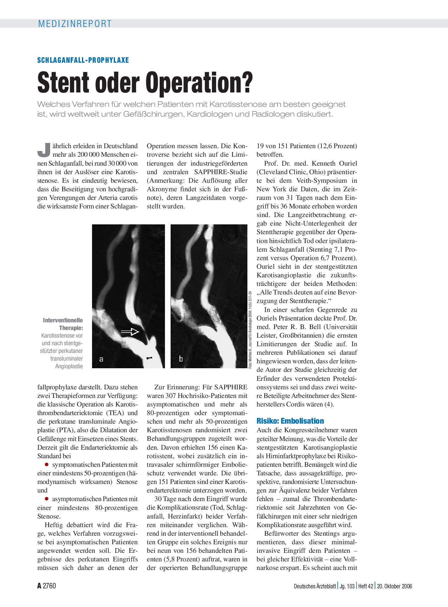 Vorschauseite 1: Schlaganfall-Prophylaxe: Stent oder Operation? – Deutsches Ärzteblatt