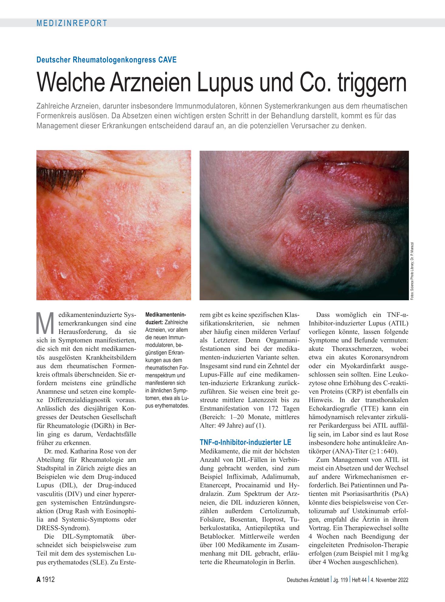Vorschauseite 1: Deutscher Rheumatologenkongress CAVE: Welche Arzneien Lupus und Co. triggern – Deutsches Ärzteblatt