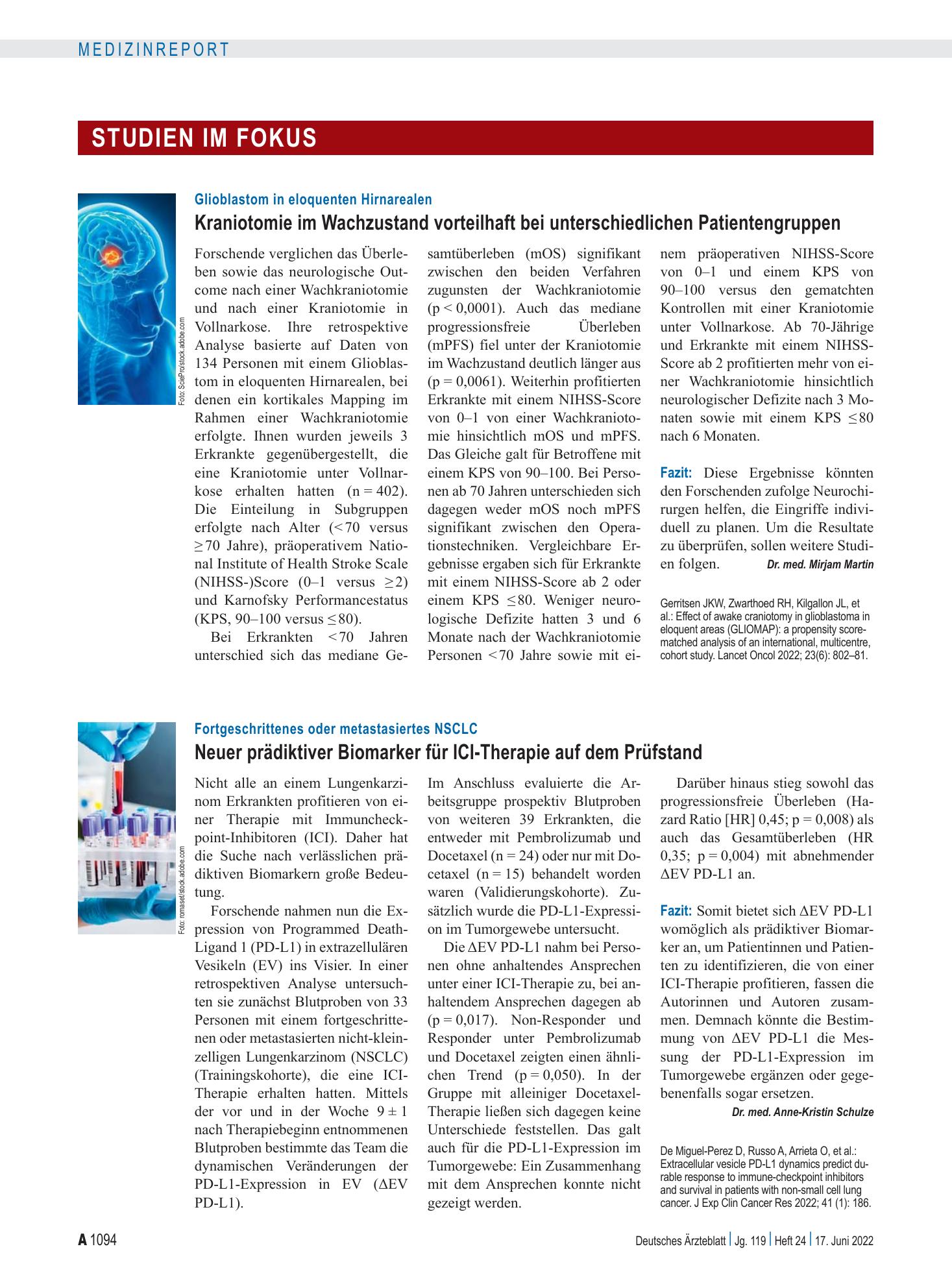 Vorschauseite 1: Fortgeschrittenes oder metastasiertes NSCLC: Neuer prädiktiver Biomarker für ICI-Therapie auf dem Prüfstand – Deutsches Ärzteblatt