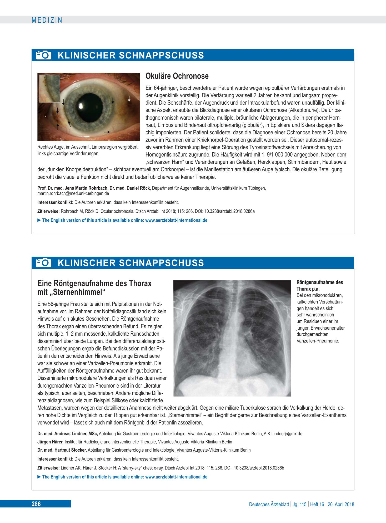 Vorschauseite 1: Okuläre Ochronose – Deutsches Ärzteblatt