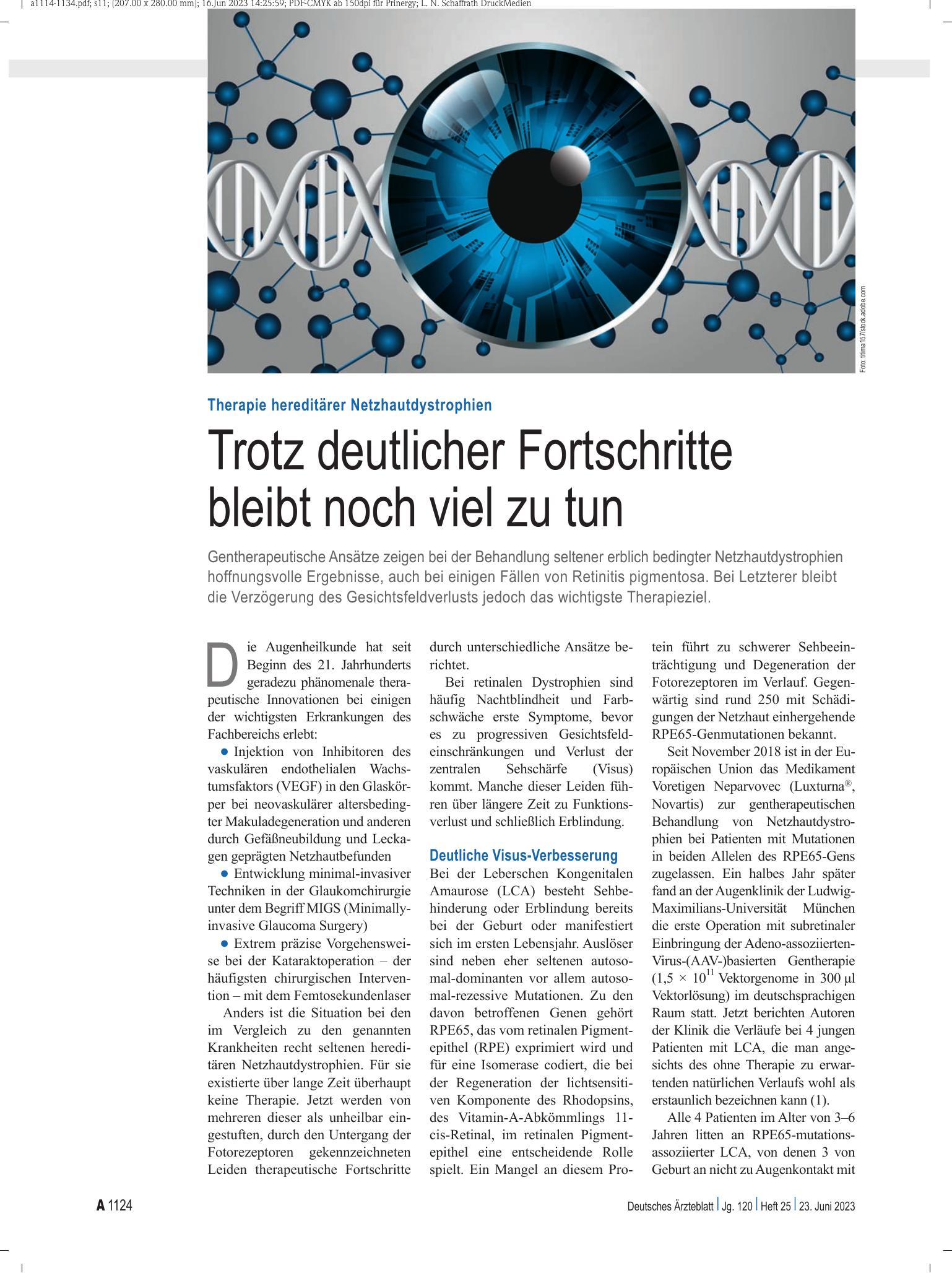 Vorschauseite 1: Therapie hereditärer Netzhautdystrophien: Trotz deutlicher Fortschritte bleibt noch viel zu tun – Deutsches Ärzteblatt