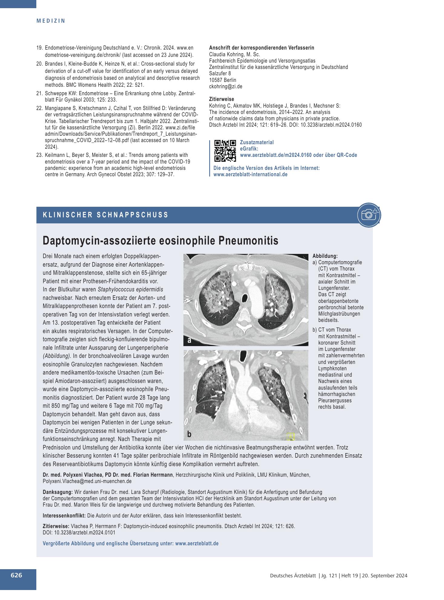 Vorschauseite 1: Daptomycin-assoziierte eosinophile Pneumonitis – Deutsches Ärzteblatt