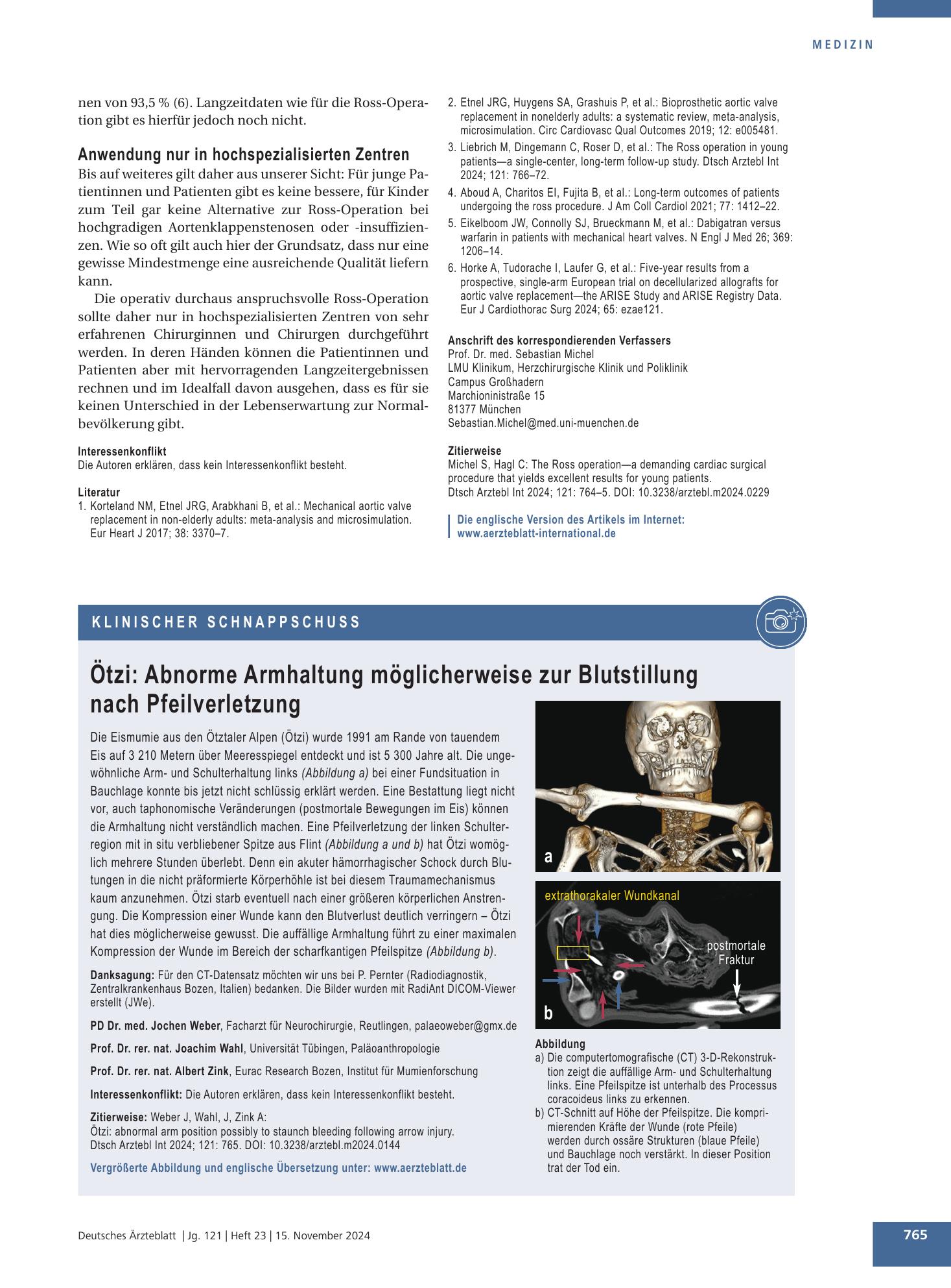 Vorschauseite 1: Ötzi: Abnorme Armhaltung möglicherweise zur Blutstillung nach Pfeilverletzung – Deutsches Ärzteblatt