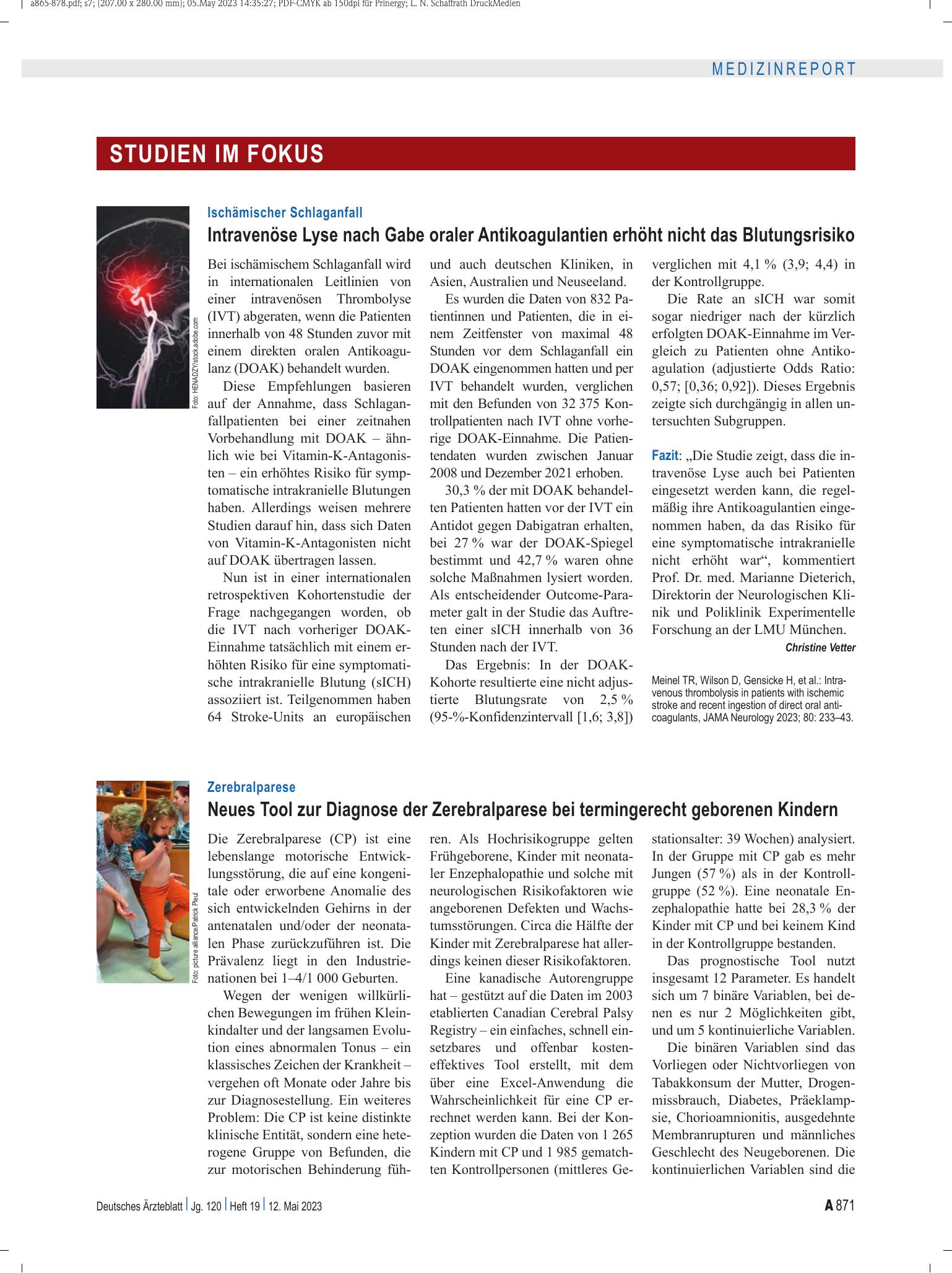 Vorschauseite 1: Ischämischer Schlaganfall: Intravenöse Lyse nach Gabe oraler Antikoagulantien erhöht nicht das Blutungsrisiko – Deutsches Ärzteblatt