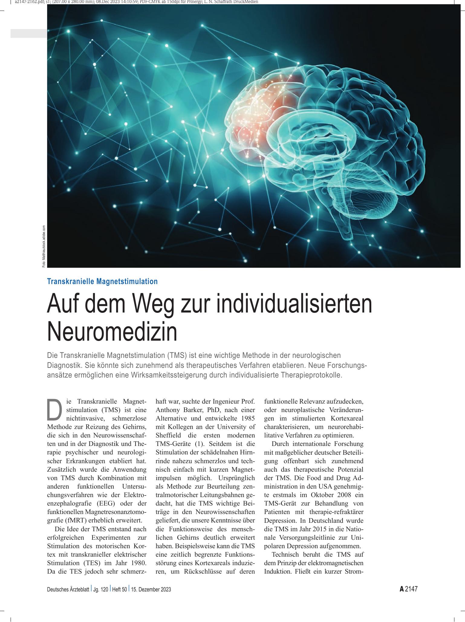 Vorschauseite 1: Transkranielle Magnetstimulation: Auf dem Weg zur individualisierten Neuromedizin – Deutsches Ärzteblatt