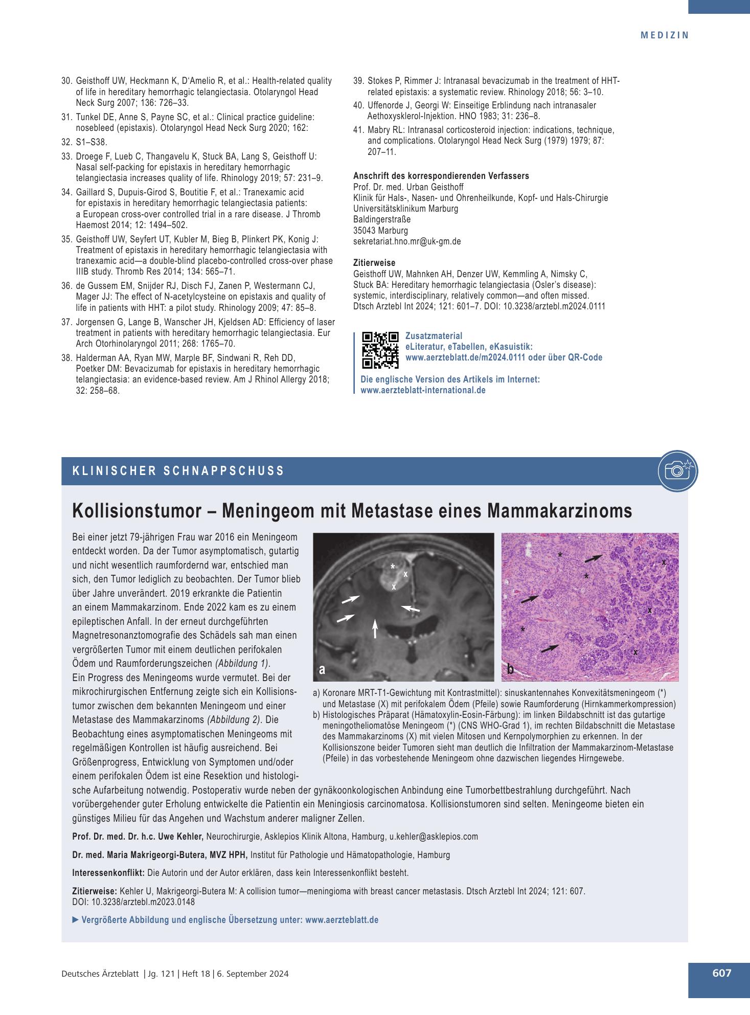Vorschauseite 1: Kollisionstumor – Meningeom mit Metastase eines Mammakarzinoms – Deutsches Ärzteblatt