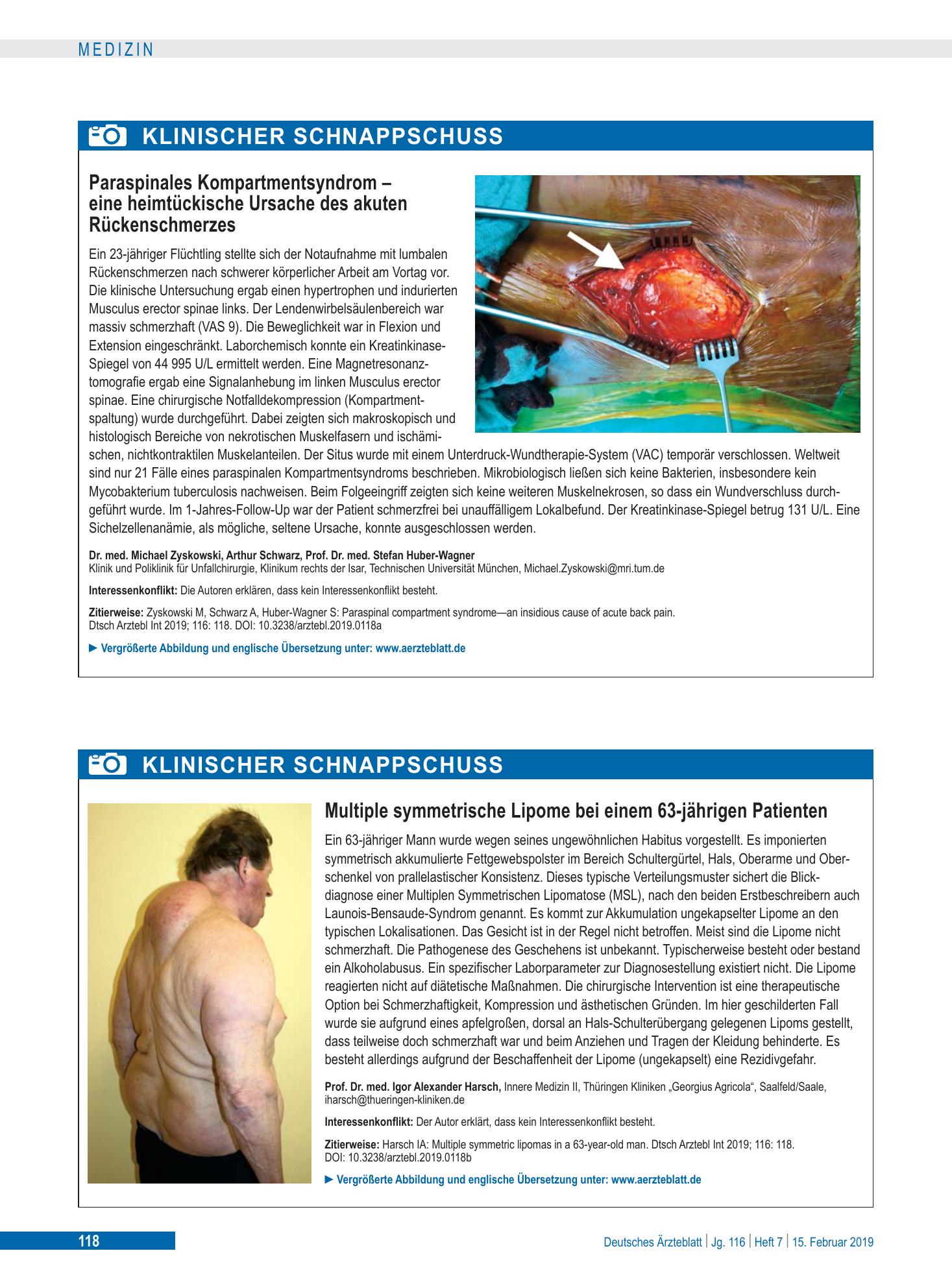Vorschauseite 1: Multiple symmetrische Lipome bei einem 63-jährigen Patienten – Deutsches Ärzteblatt