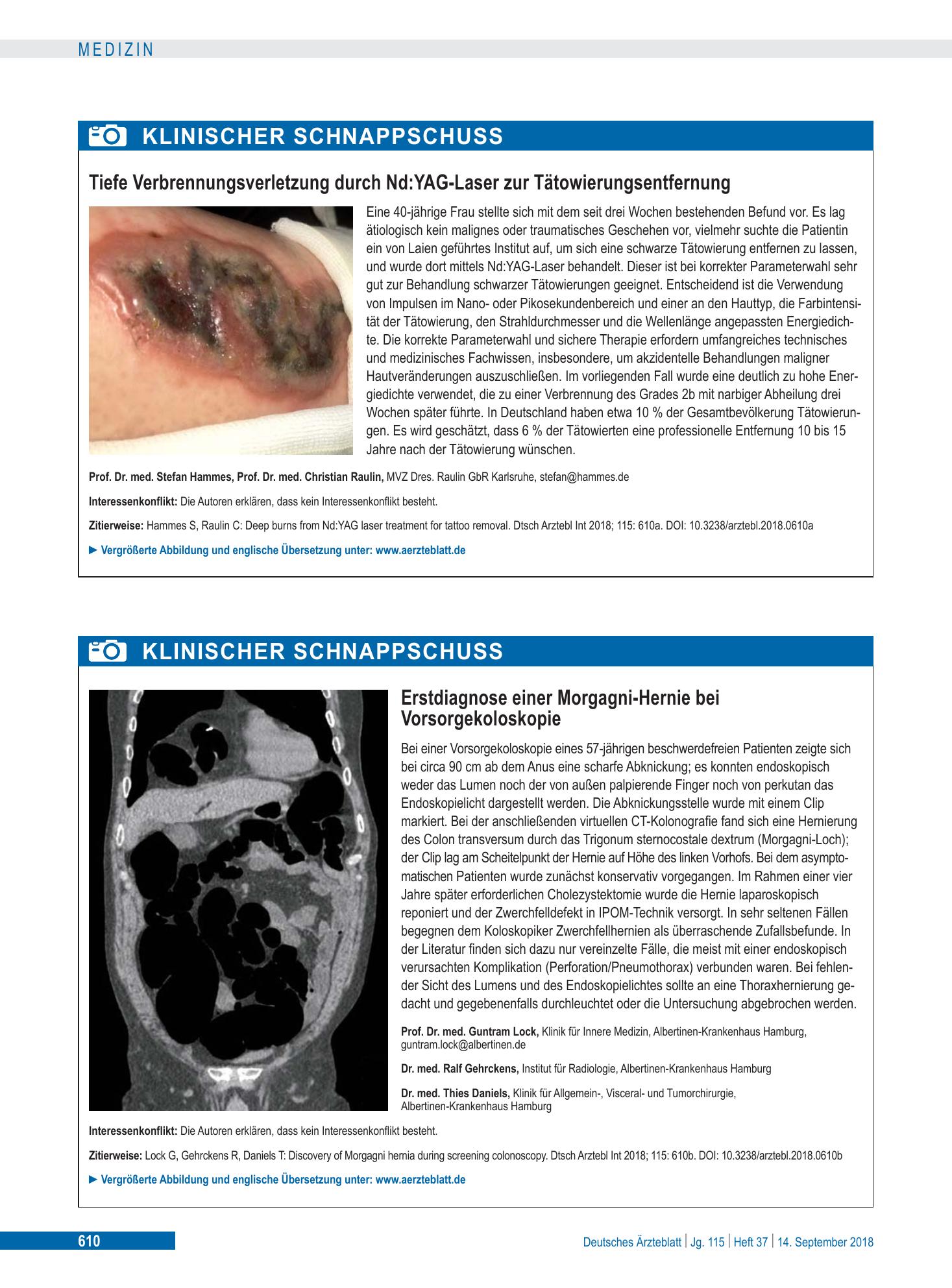 Vorschauseite 1: Erstdiagnose einer Morgagni-Hernie bei Vorsorgekoloskopie – Deutsches Ärzteblatt