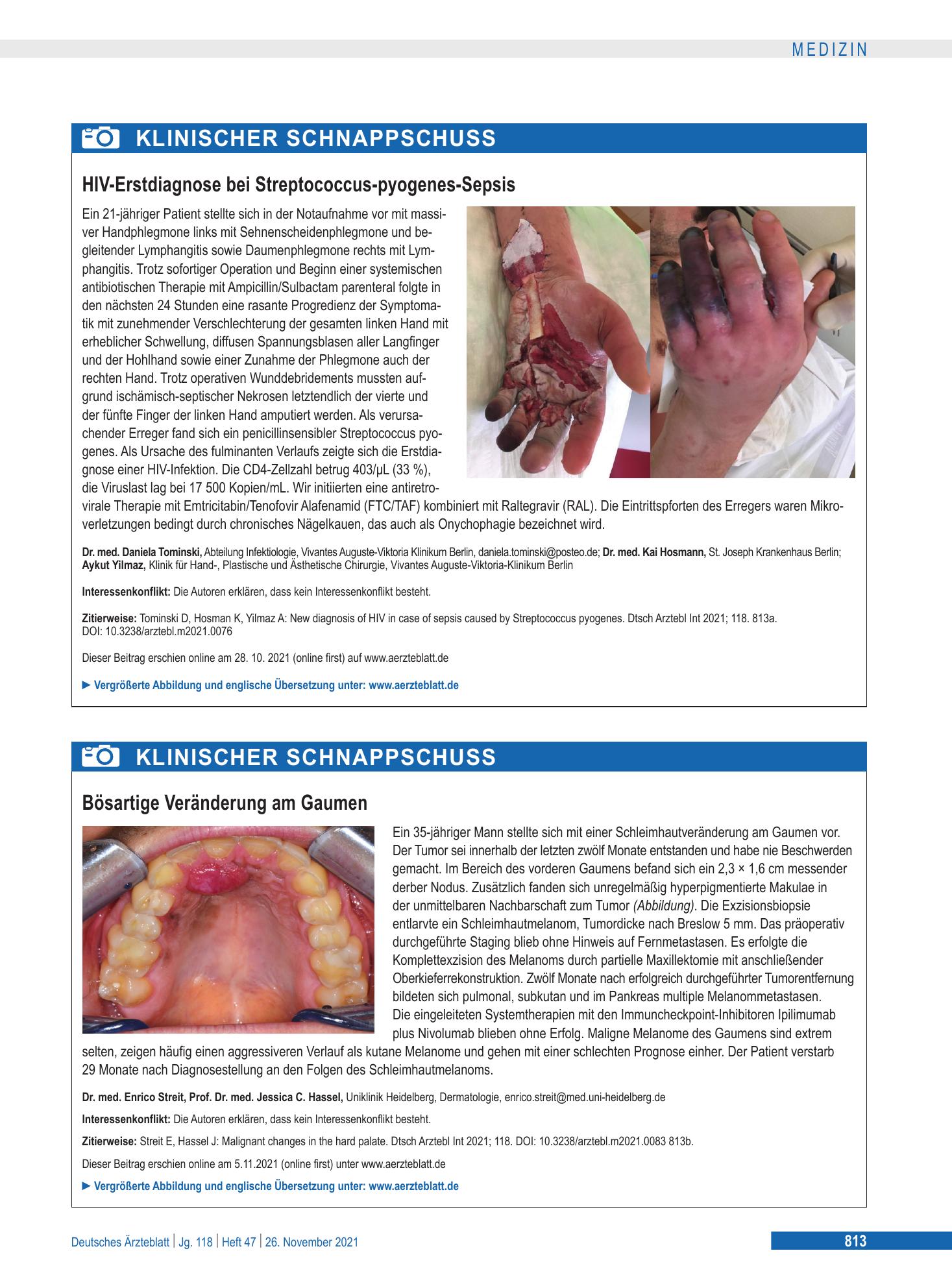 Vorschauseite 1: HIV-Erstdiagnose bei Streptococcus-pyogenes-Sepsis – Deutsches Ärzteblatt
